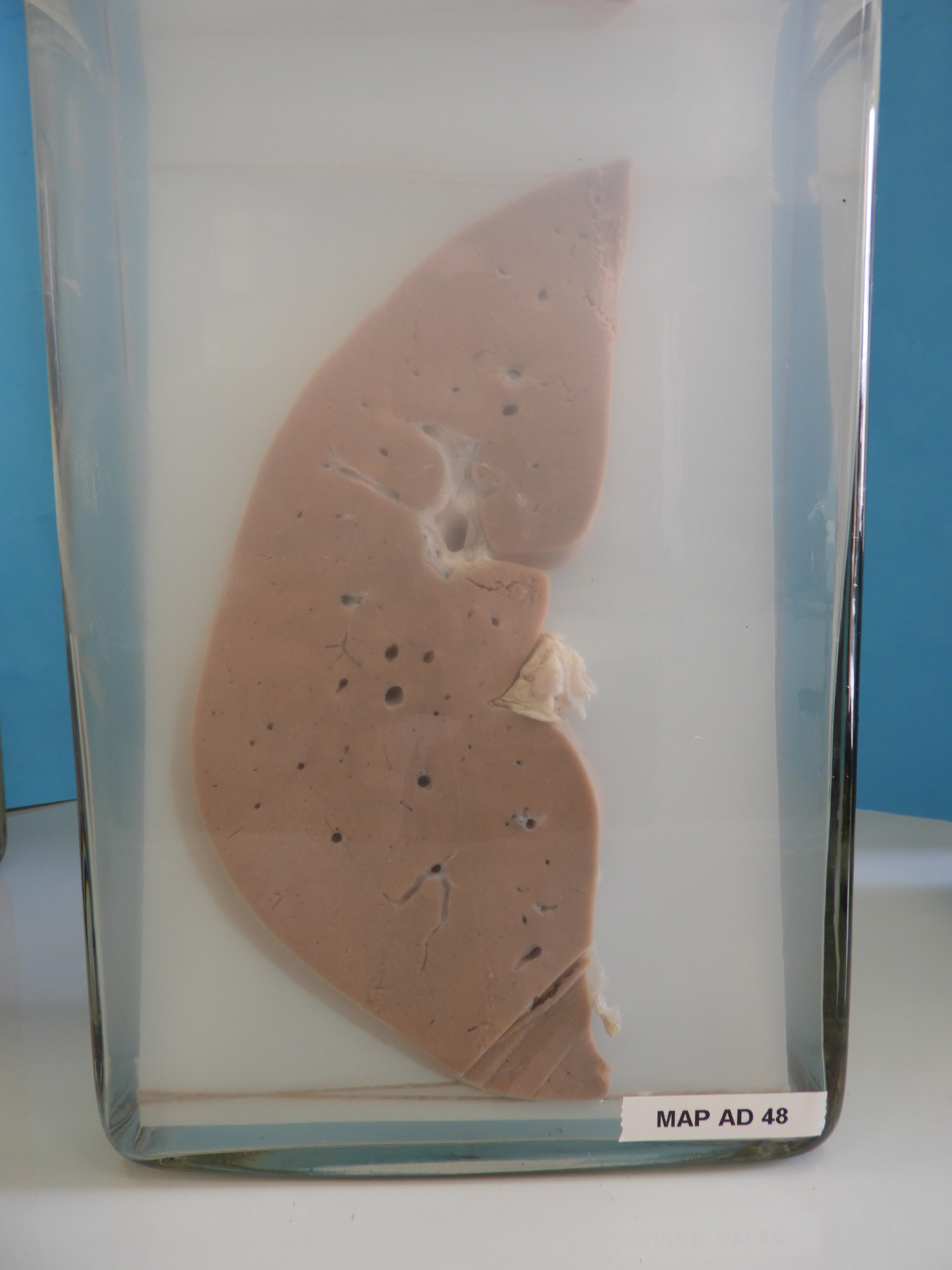 preparato anatomico, apparato digerente (morfologia naturale) (SECOLI/ XX)