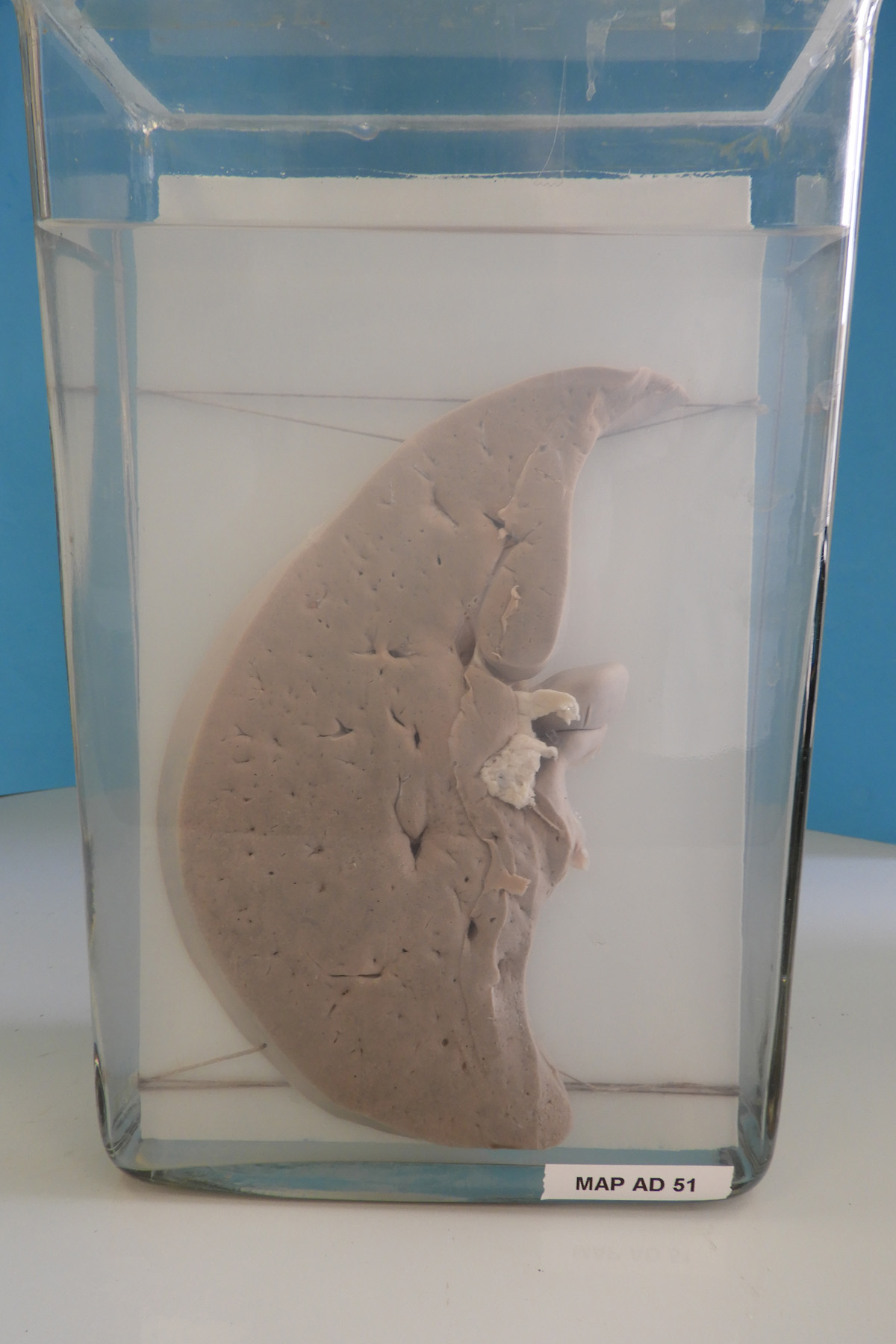 preparato anatomico, apparato digerente (morfologia naturale) (SECOLI/ XX)