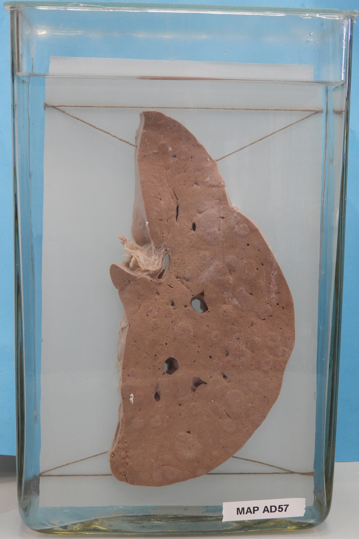 preparato anatomico, apparato digerente (morfologia naturale) (SECOLI/ XX)