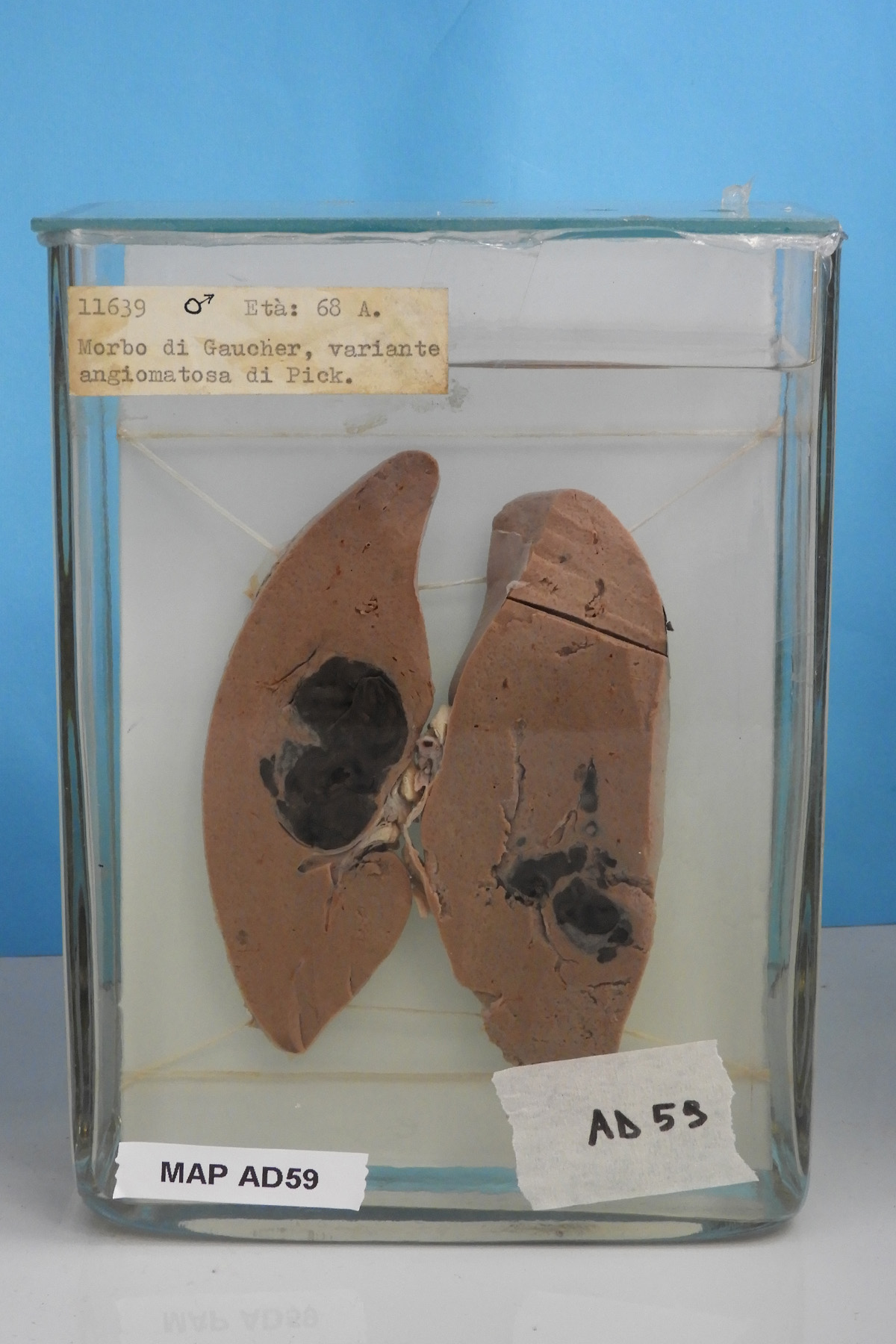 preparato anatomico, apparato digerente (morfologia naturale) (SECOLI/ XX)