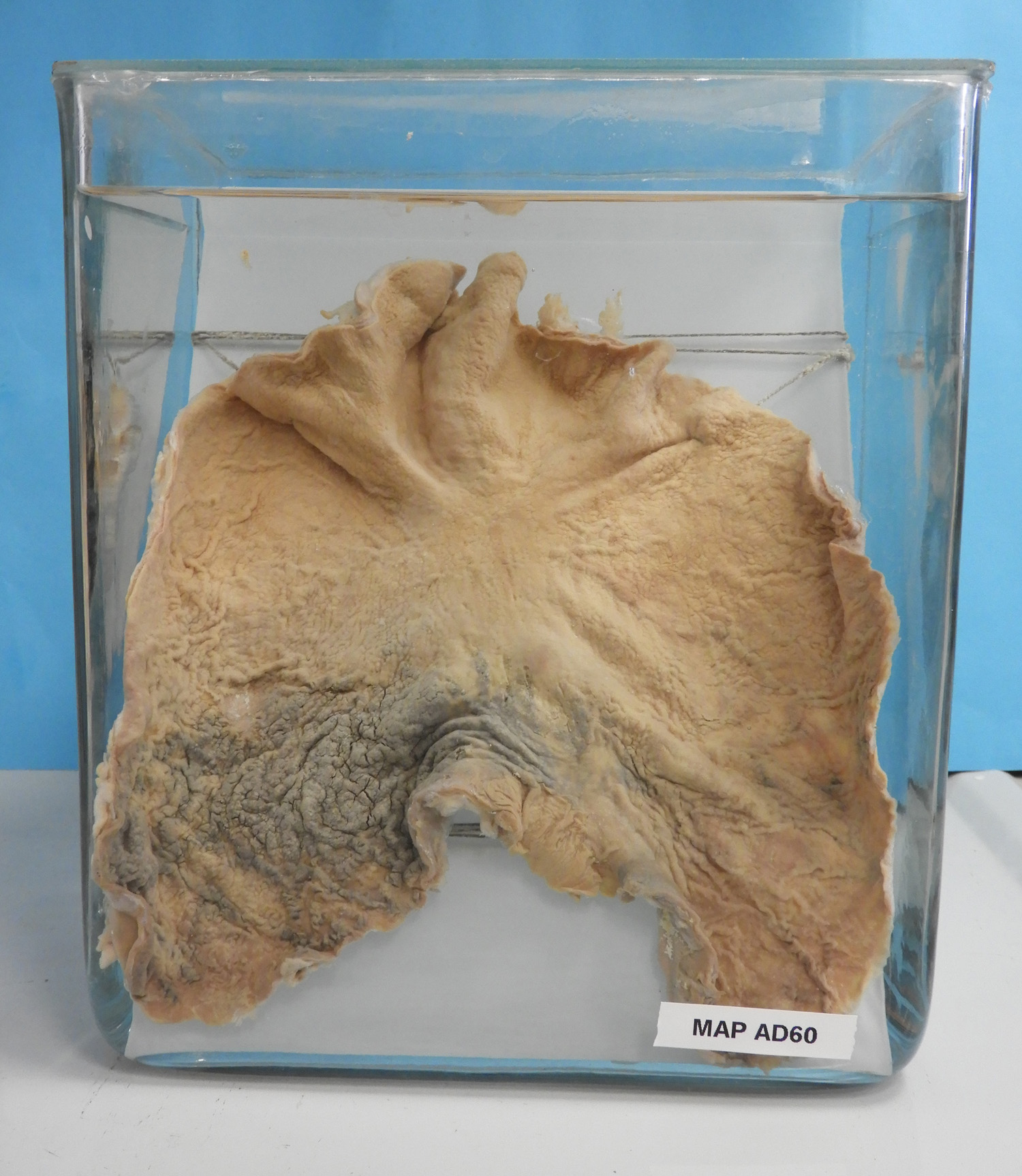 preparato anatomico, apparato digerente (morfologia naturale) (SECOLI/ XX)