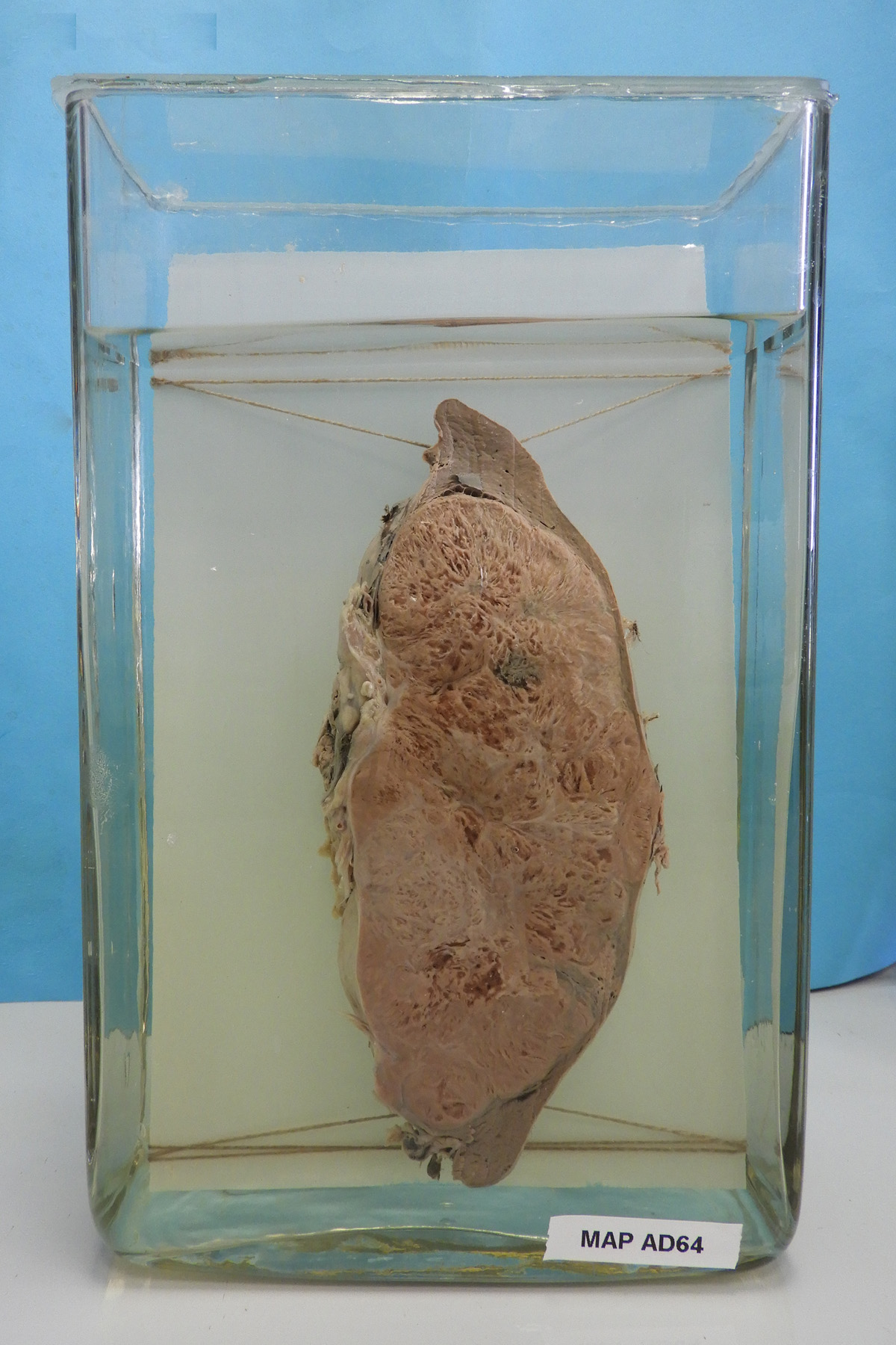 preparato anatomico, sistema linfatico (morfologia naturale) (SECOLI/ XX)