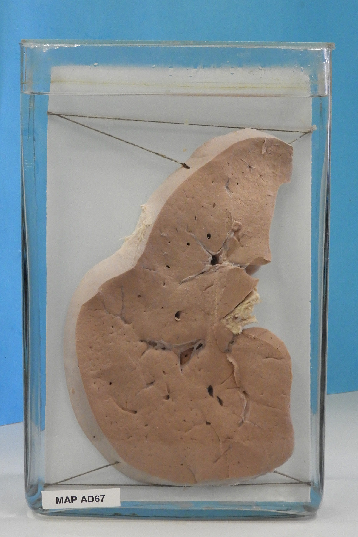 preparato anatomico, apparato digerente (morfologia naturale) (SECOLI/ XX)