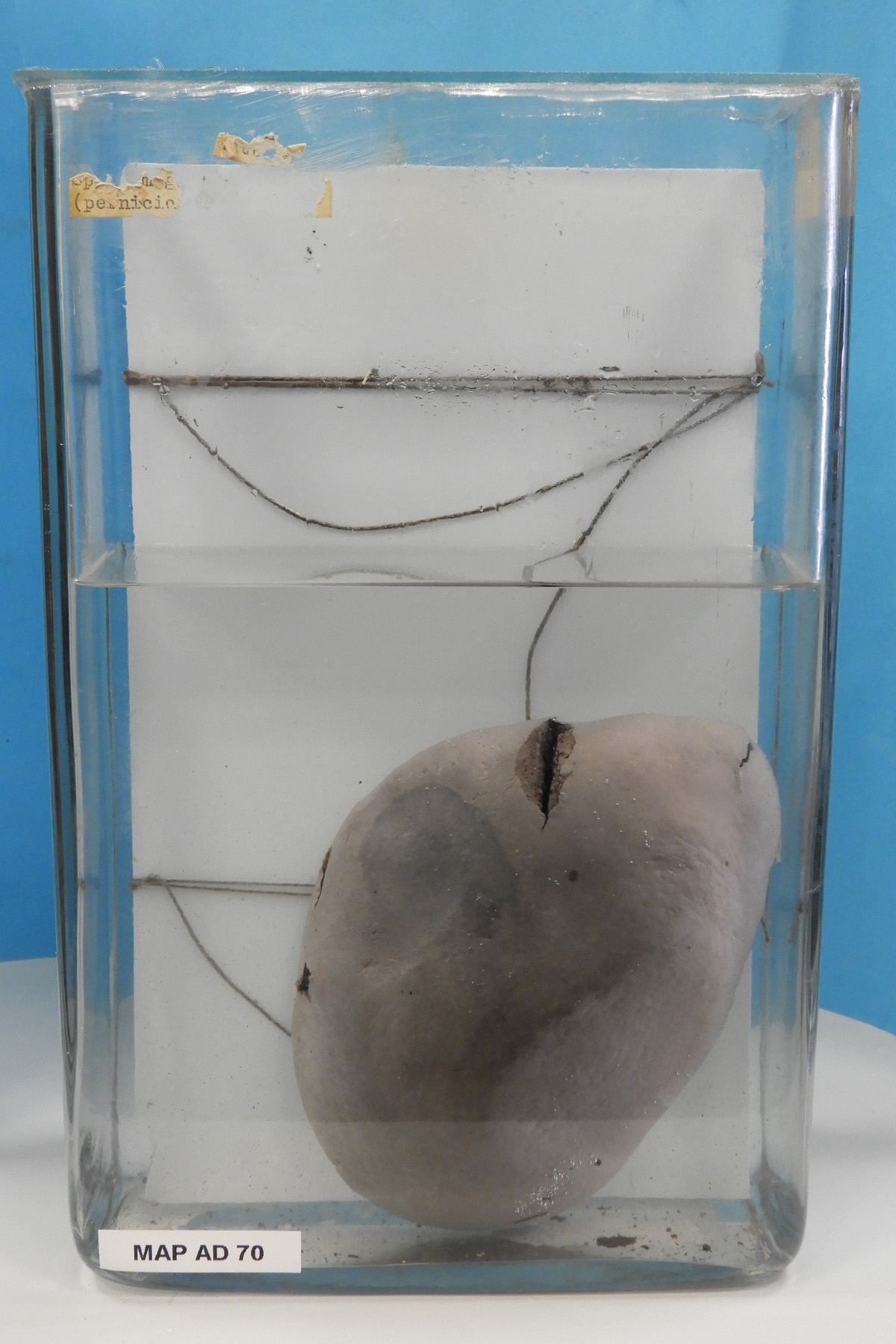 preparato anatomico, apparato digerente (morfologia naturale) (SECOLI/ XX)