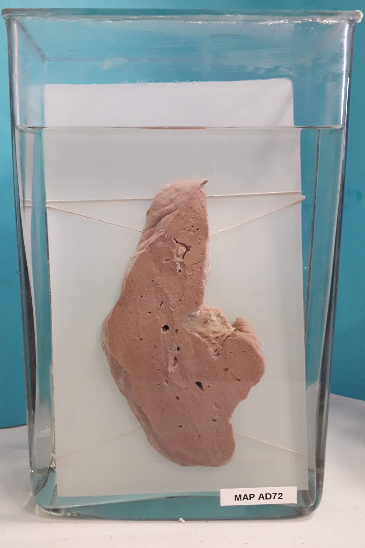 preparato anatomico, apparato digerente (morfologia naturale) (SECOLI/ XX)