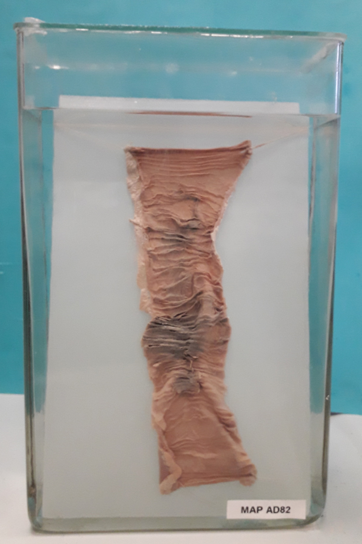 preparato anatomico, apparato digerente (morfologia naturale) (SECOLI/ XX)