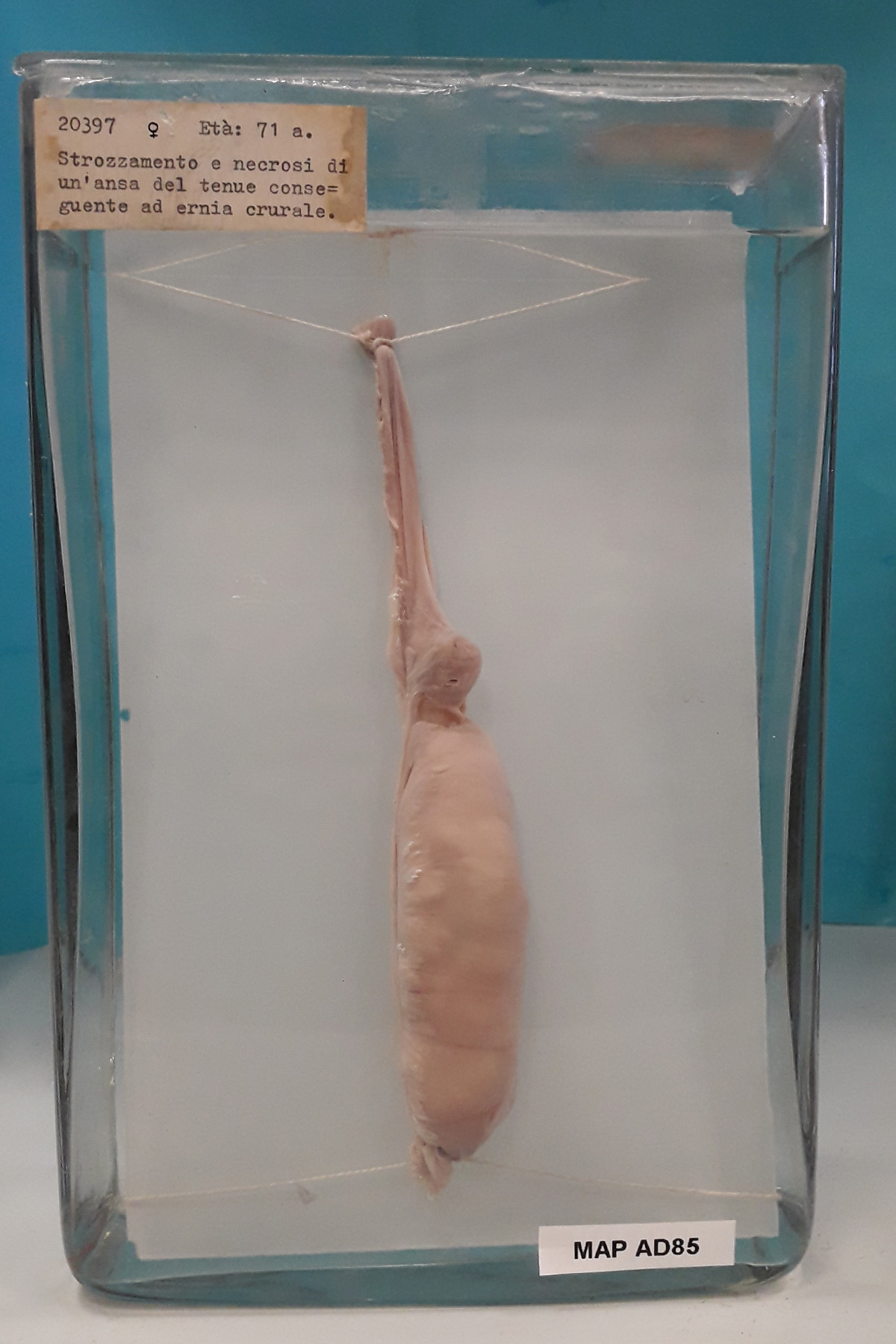 preparato anatomico, apparato digerente (morfologia naturale) (SECOLI/ XX)