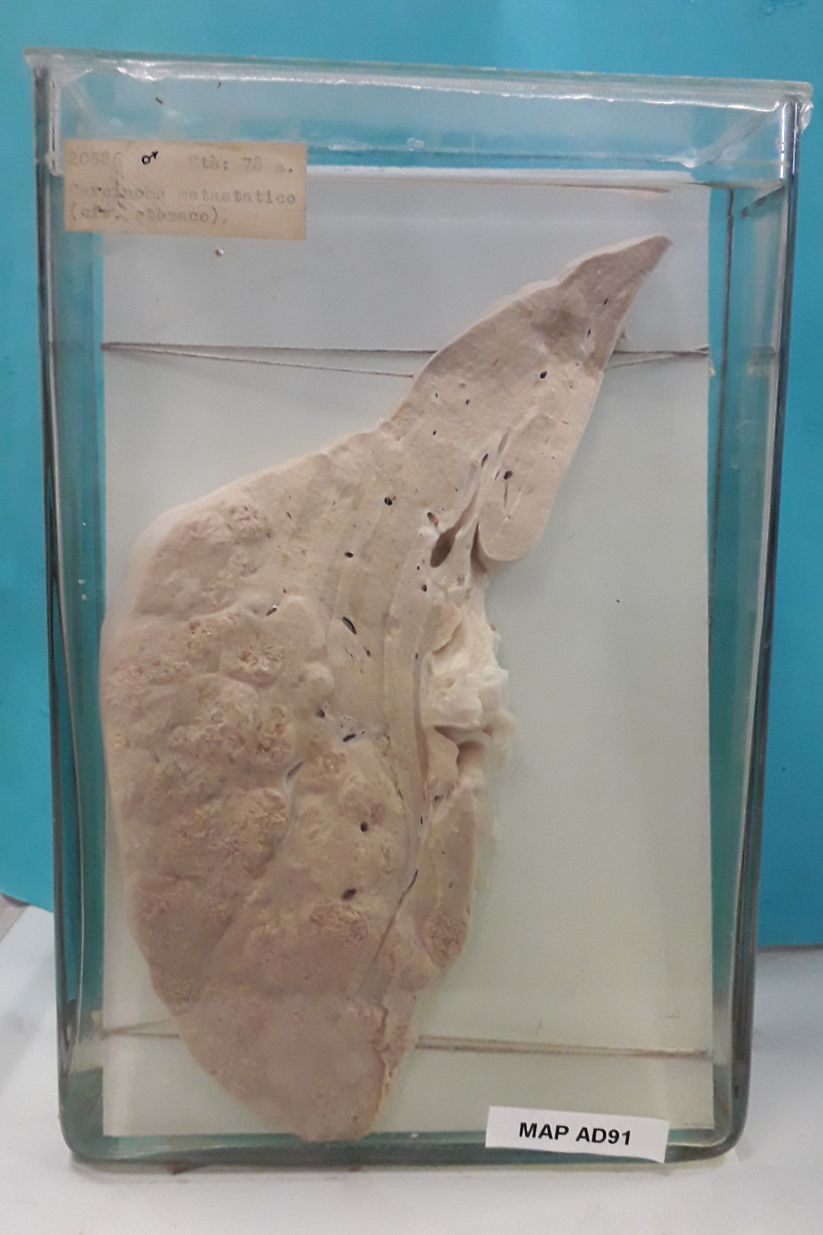 preparato anatomico, apparato digerente (morfologia naturale) (SECOLI/ XX)