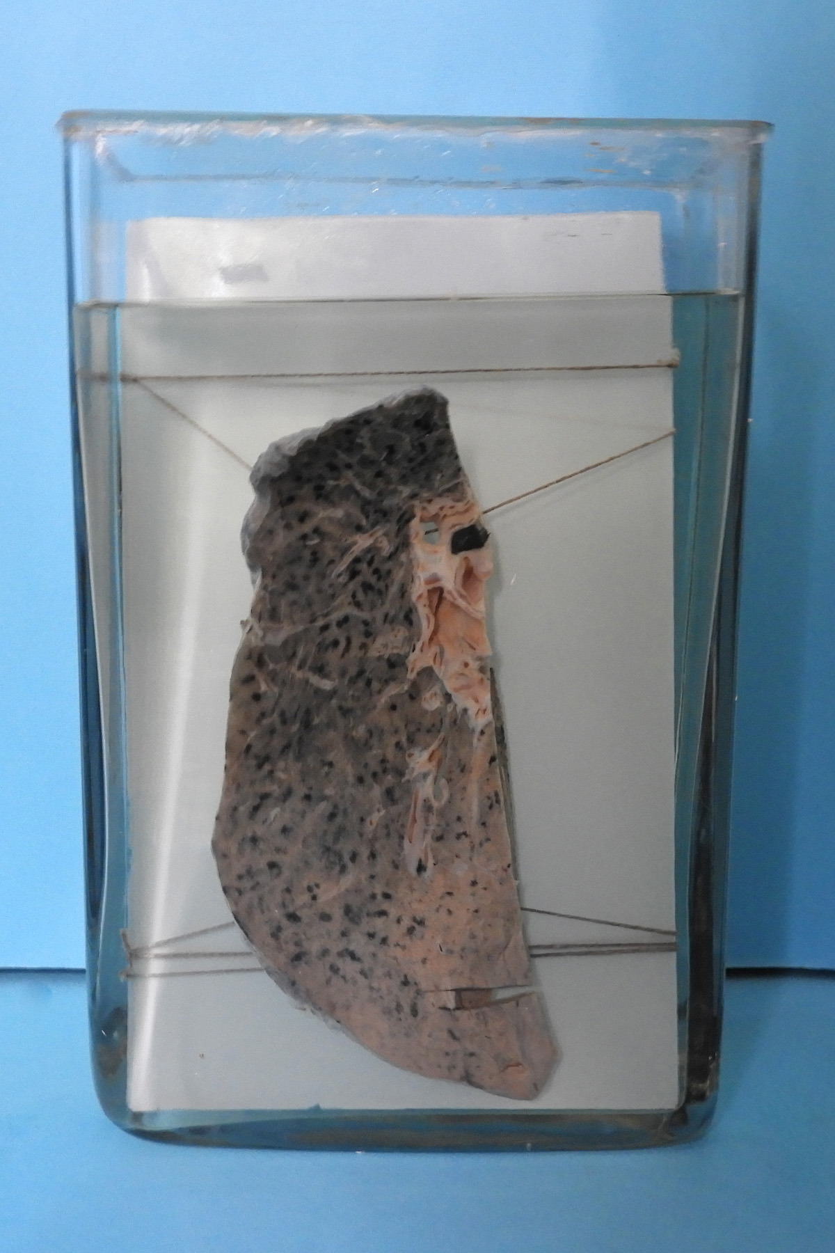 preparato anatomico, apparato respiratorio (morfologia naturale) (SECOLI/ XX)