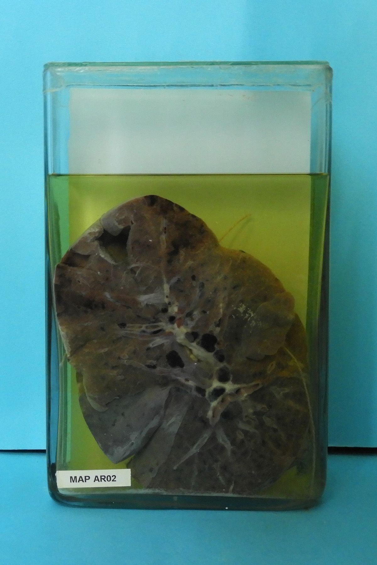 preparato anatomico, apparato respiratorio (morfologia naturale) (SECOLI/ XX)