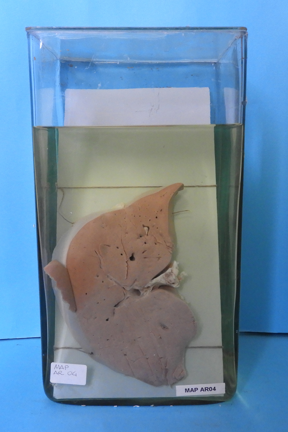 preparato anatomico, apparato respiratorio (morfologia naturale) (SECOLI/ XX)