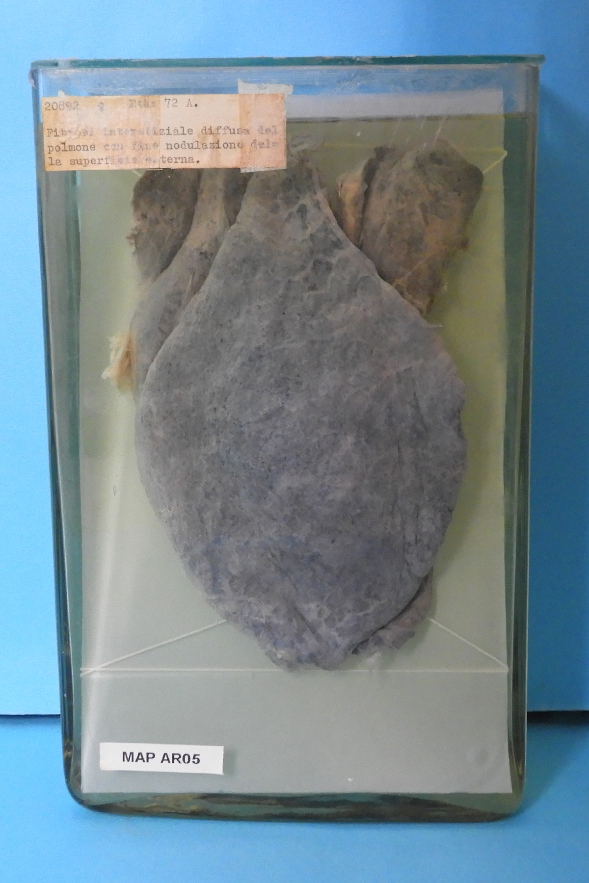 preparato anatomico, apparato respiratorio (morfologia naturale) (SECOLI/ XX)