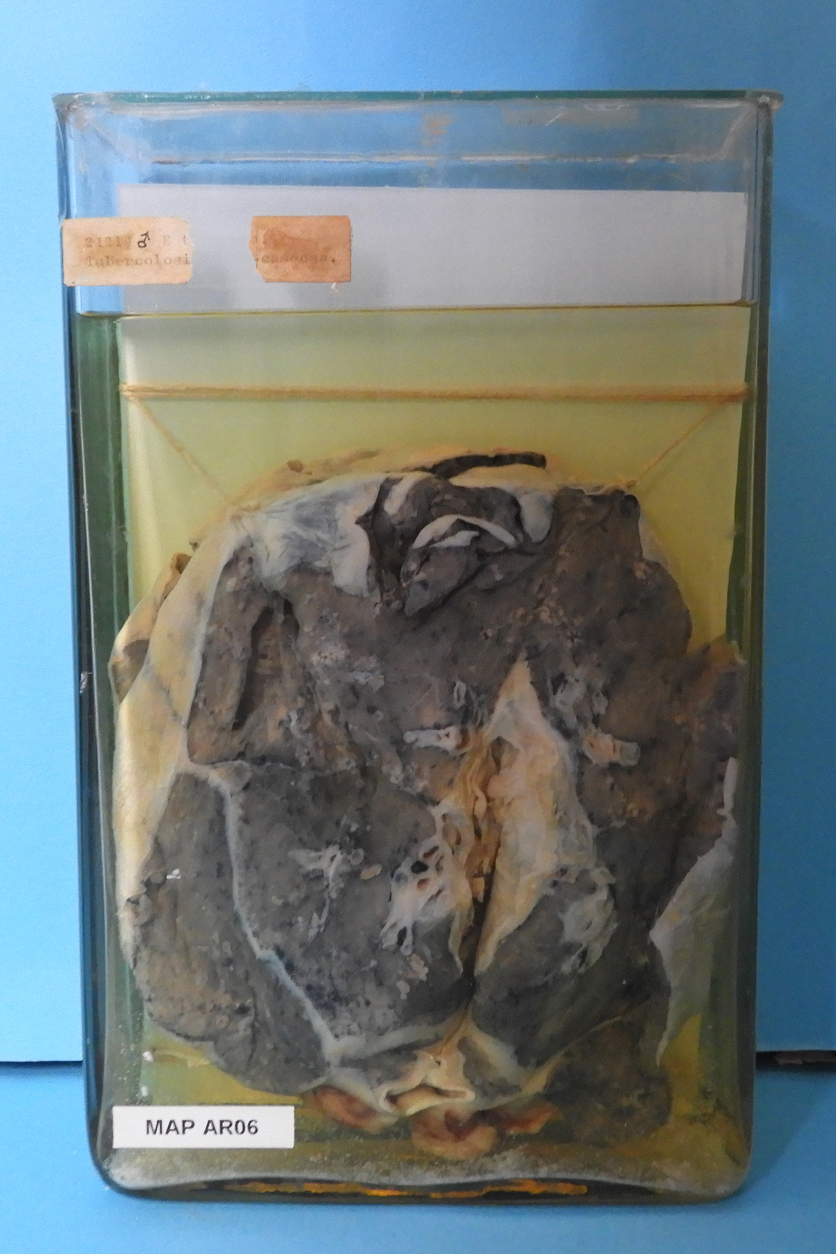 preparato anatomico, apparato respiratorio (morfologia naturale) (SECOLI/ XX)