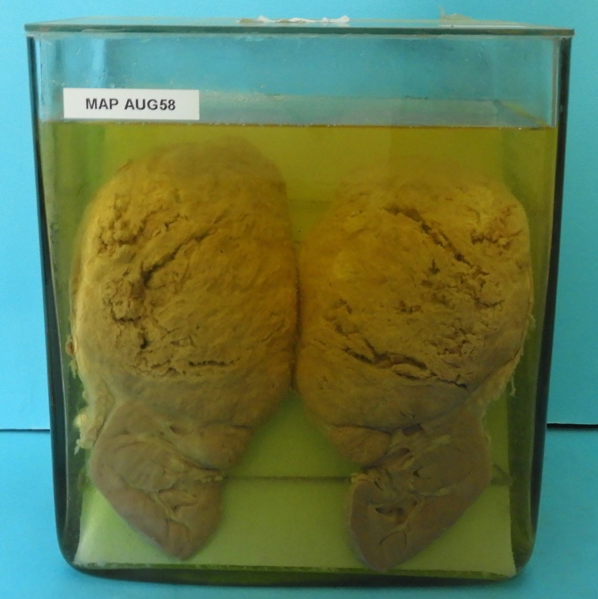 preparato anatomico, apparato respiratorio (morfologia naturale) (SECOLI/ XX)