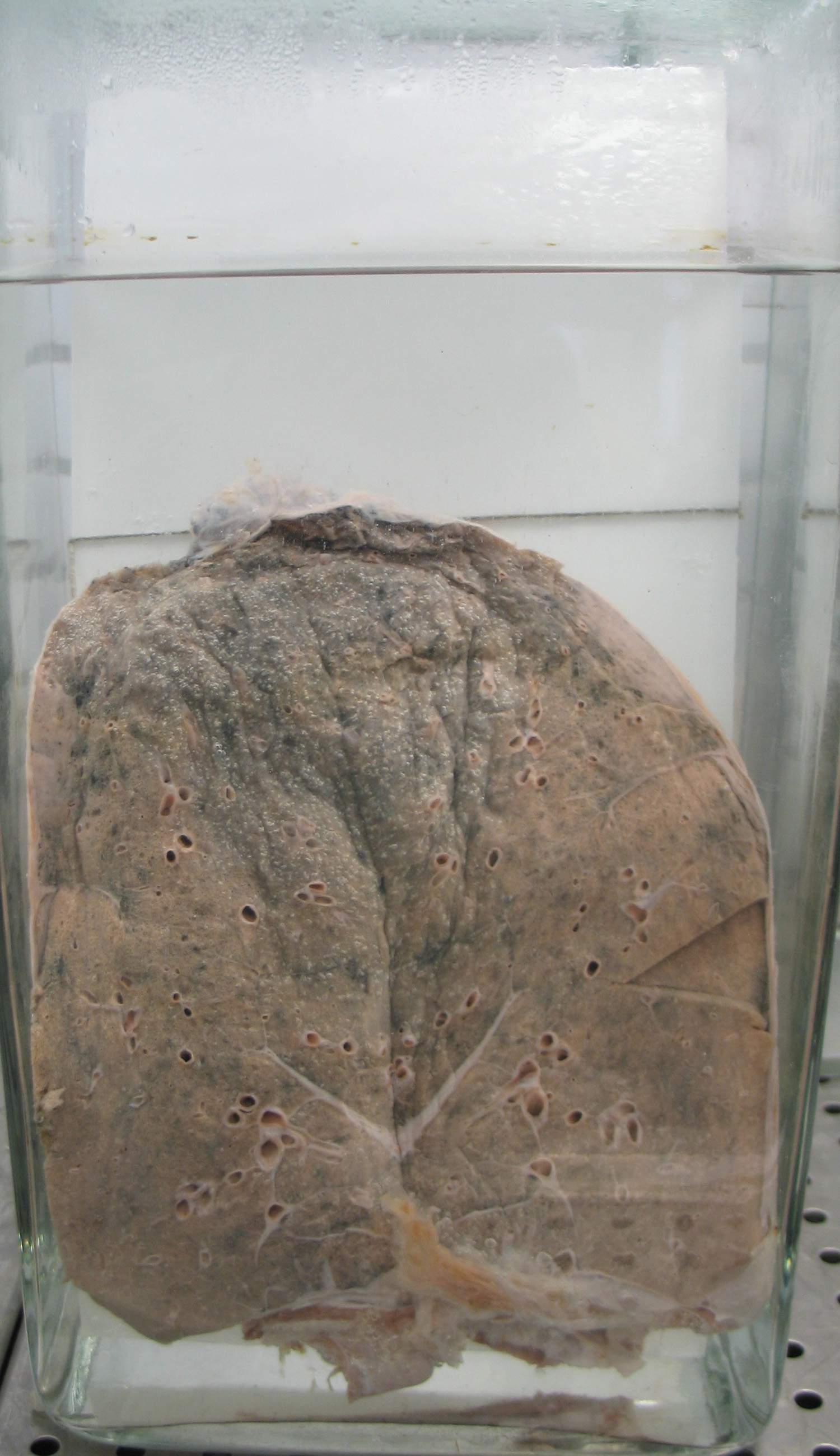 preparato anatomico, apparato respiratorio (morfologia naturale) (SECOLI/ XX)