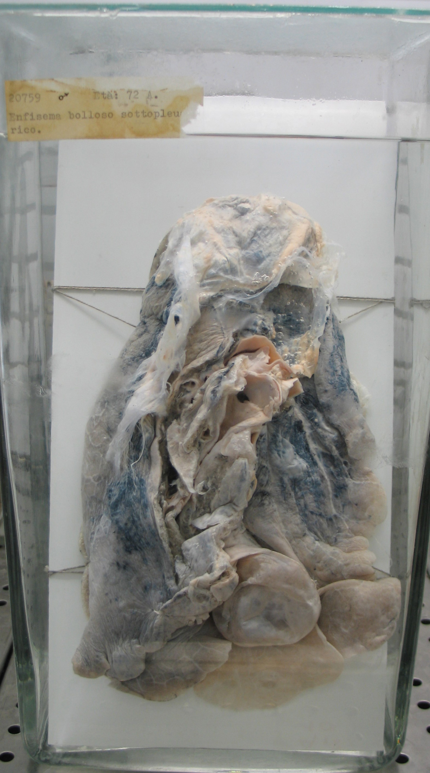 preparato anatomico, apparato respiratorio (morfologia naturale) (SECOLI/ XX)