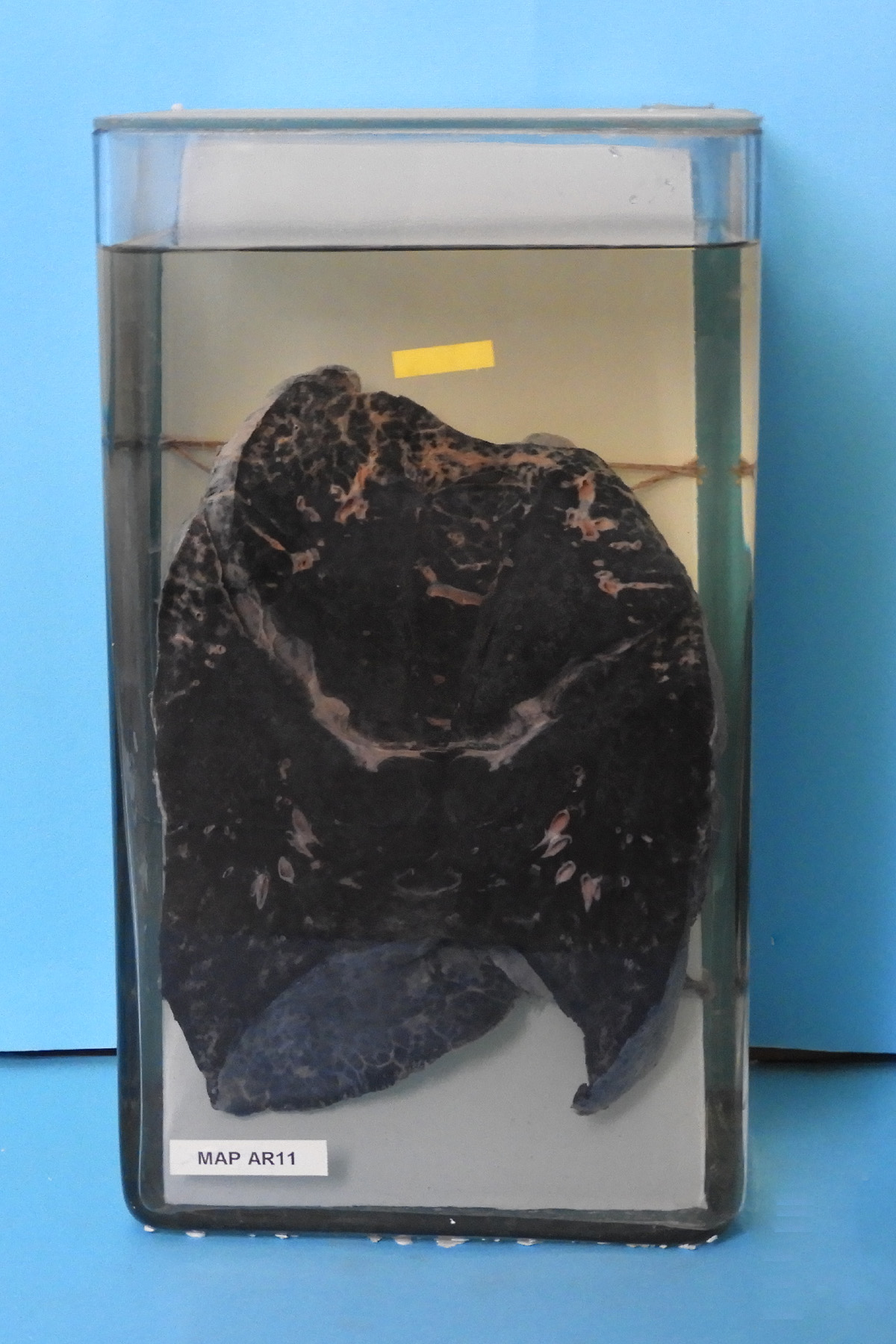 preparato anatomico, apparato respiratorio (morfologia naturale) (SECOLI/ XX)