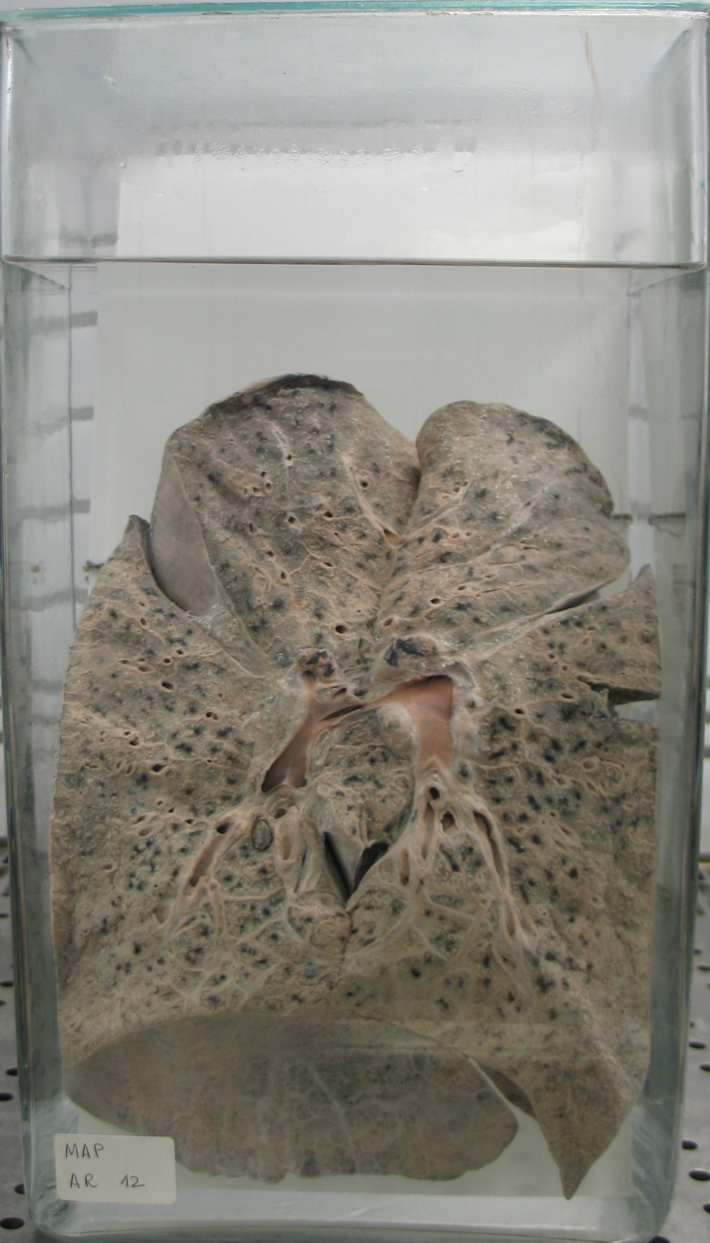 preparato anatomico, apparato respiratorio (morfologia naturale) (SECOLI/ XX)