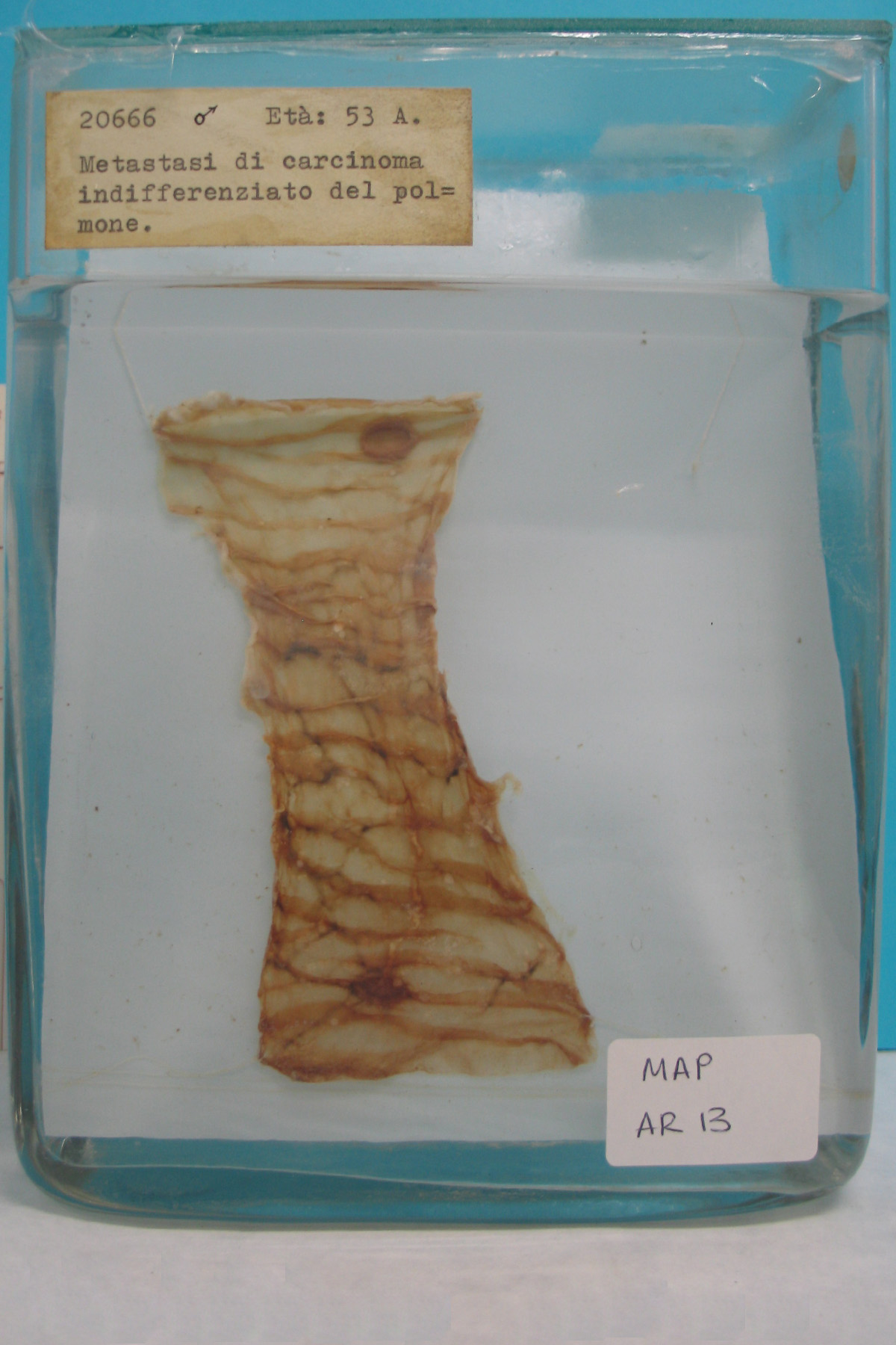 preparato anatomico, feto (morfologia naturale) (SECOLI/ XX)