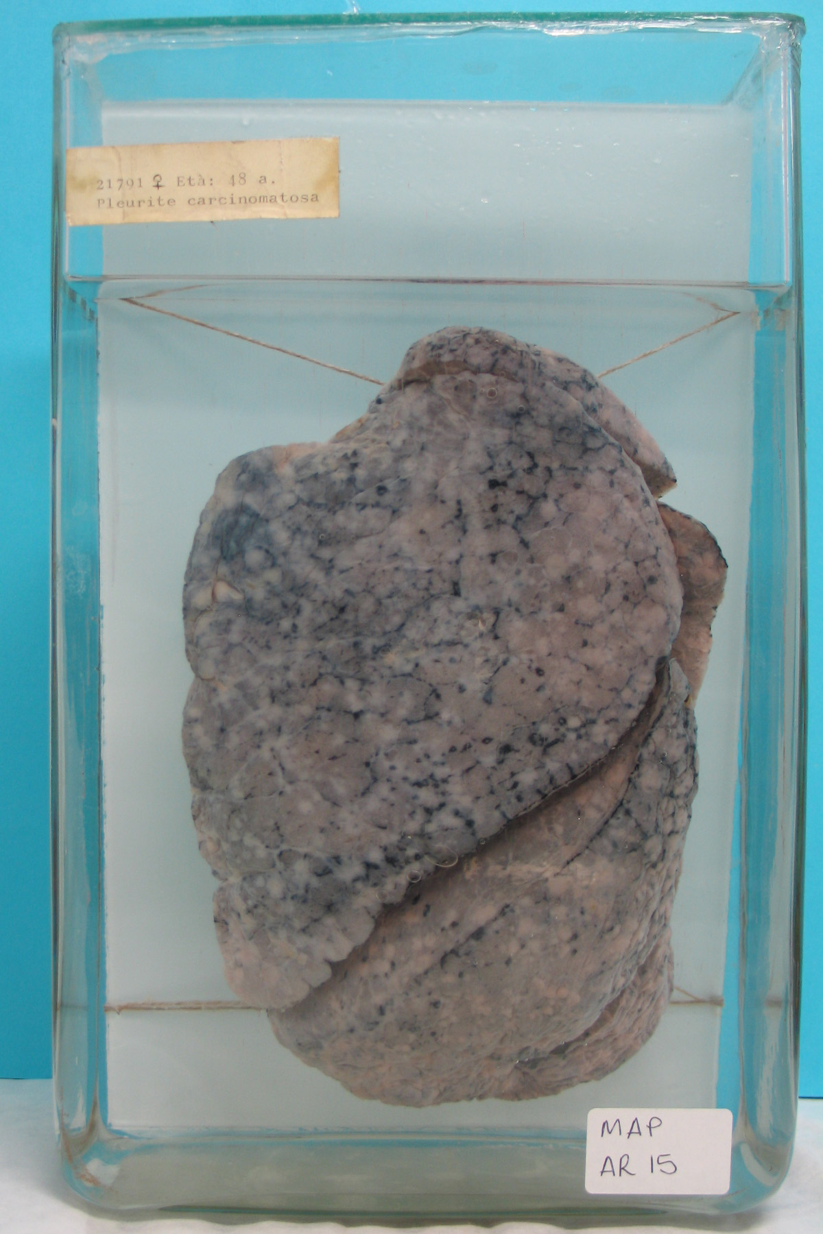 preparato anatomico, apparato respiratorio (morfologia naturale) (SECOLI/ XX)