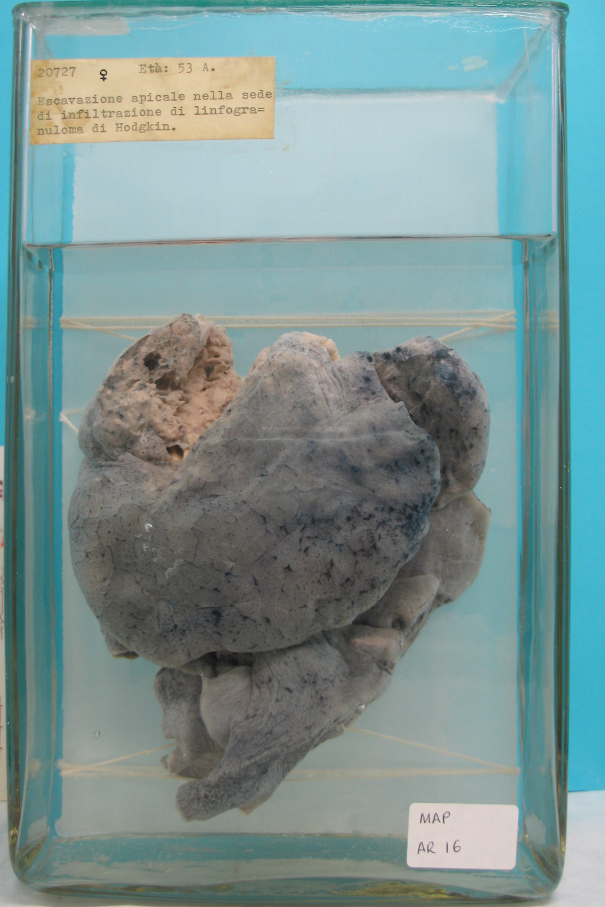 preparato anatomico, apparato respiratorio (morfologia naturale) (SECOLI/ XX)