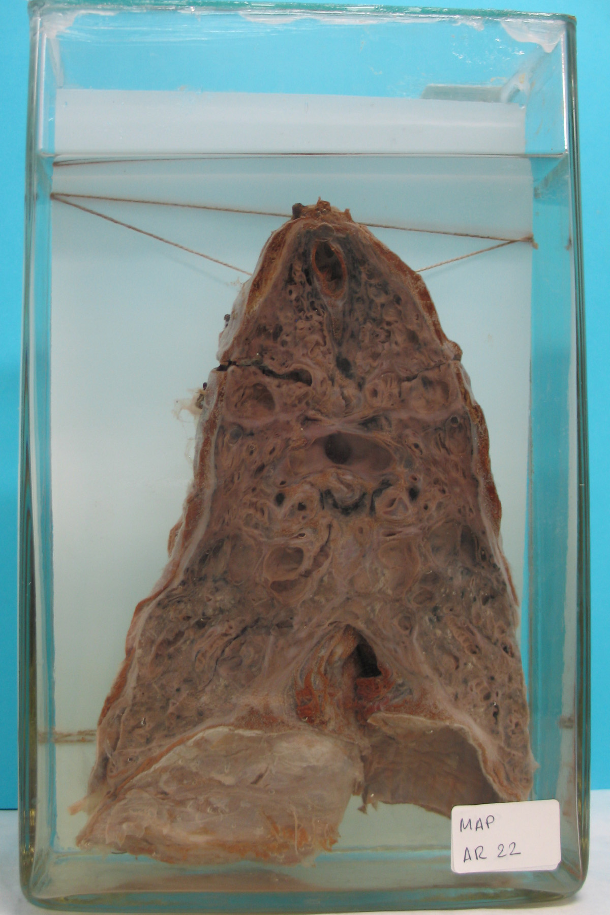 preparato anatomico, apparato respiratorio (morfologia naturale) (SECOLI/ XX)