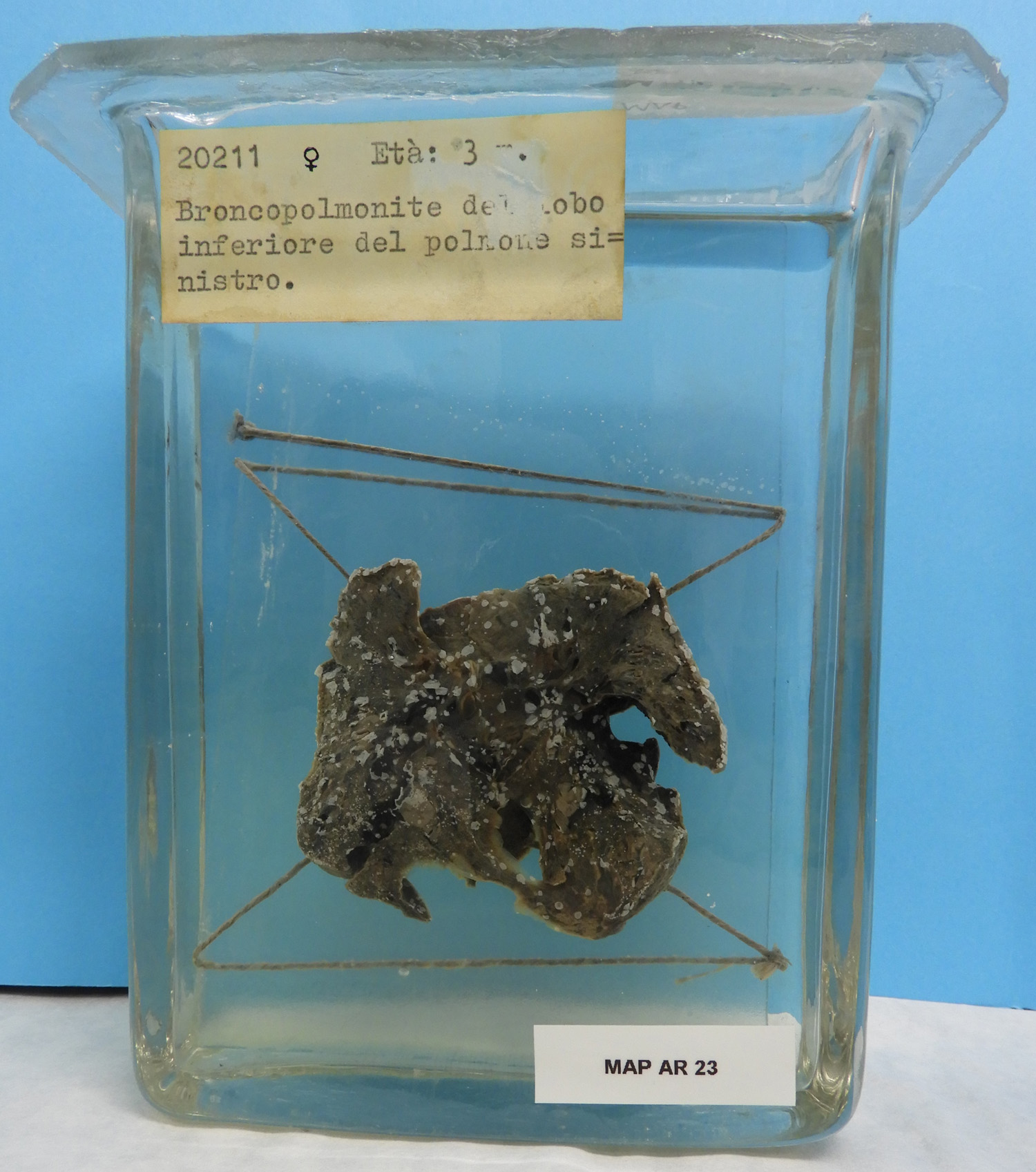 preparato anatomico, apparato respiratorio (morfologia naturale) (SECOLI/ XX)