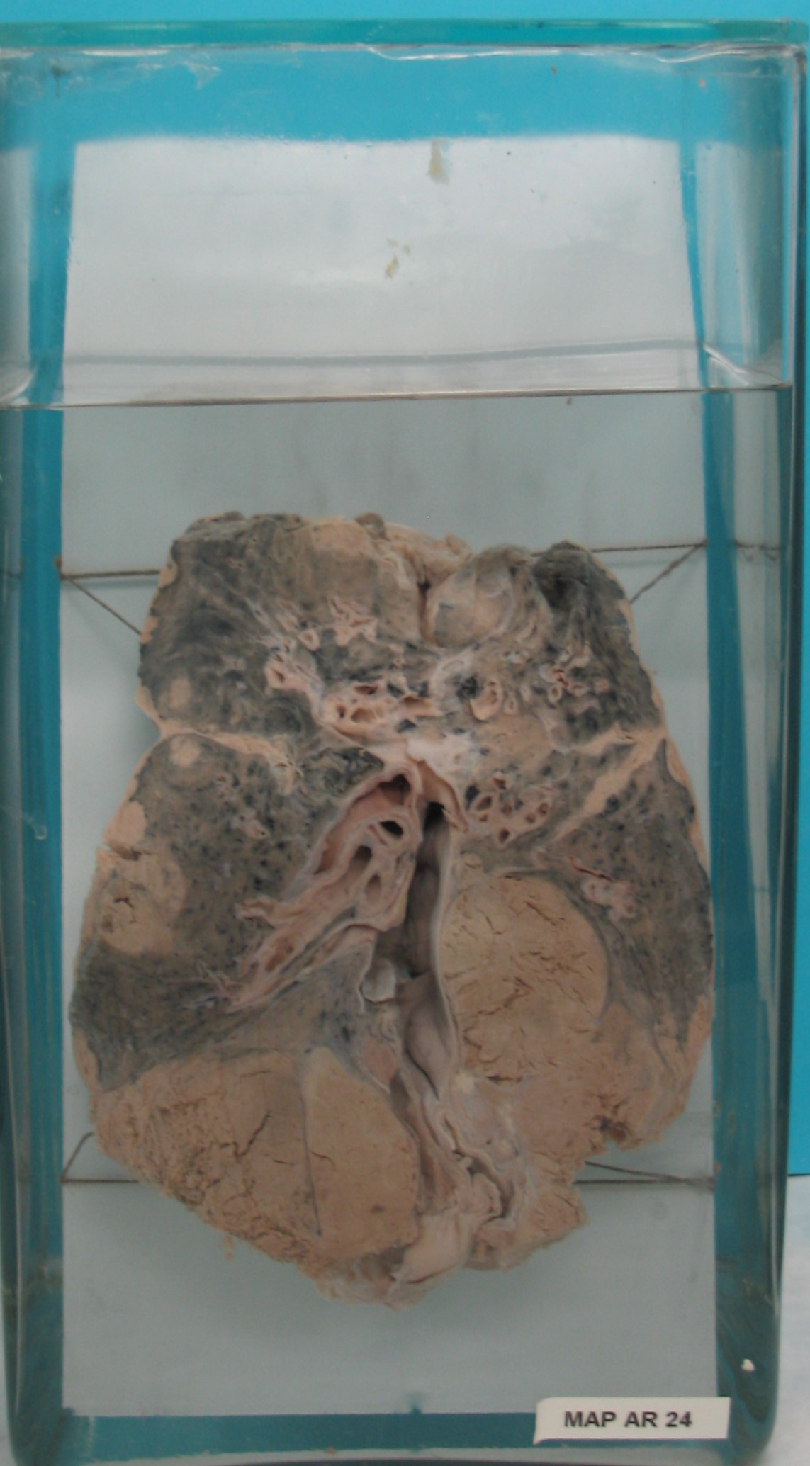 preparato anatomico, apparato respiratorio (morfologia naturale) (SECOLI/ XX)