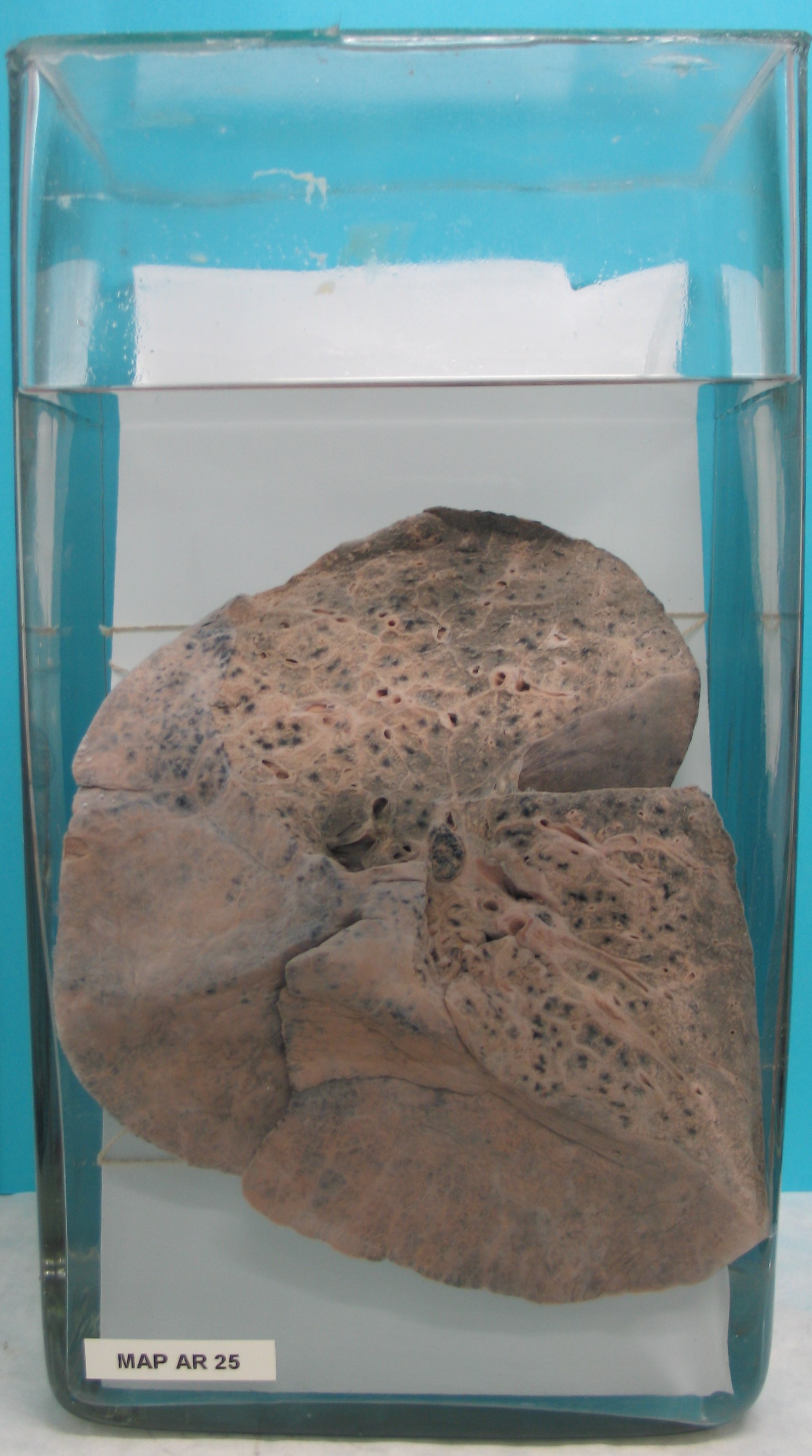 preparato anatomico, apparato respiratorio (morfologia naturale) (SECOLI/ XX)