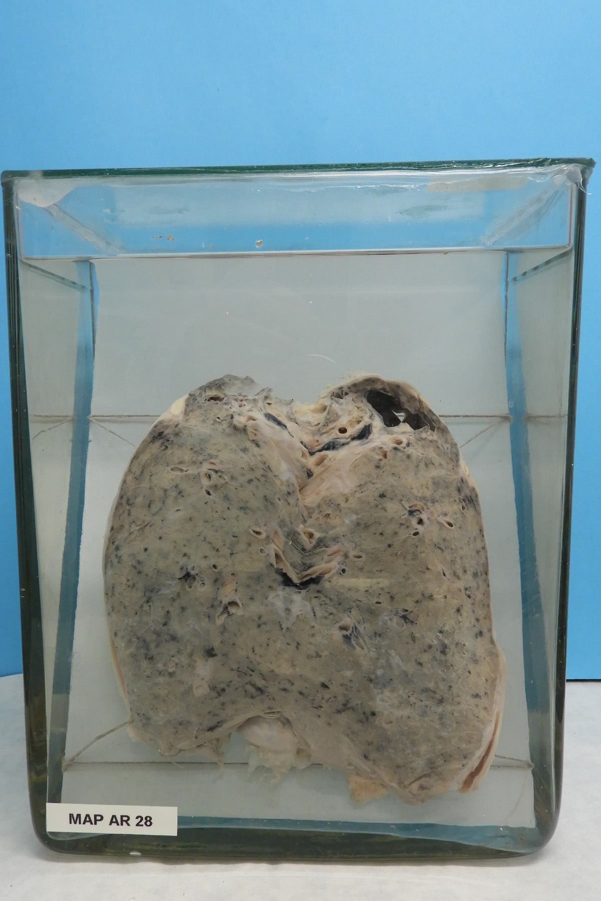 preparato anatomico, apparato respiratorio (morfologia naturale) (SECOLI/ XX)