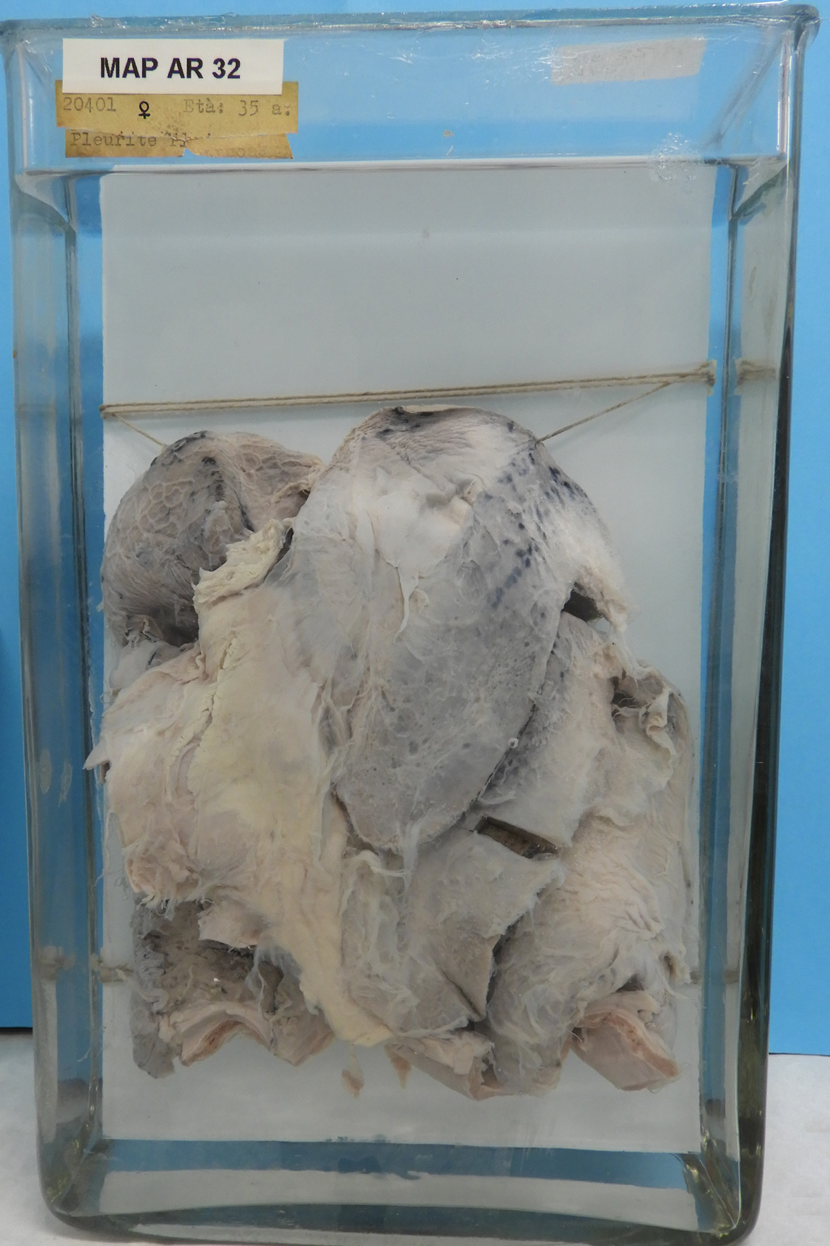 preparato anatomico, apparato respiratorio (morfologia naturale) (SECOLI/ XX)