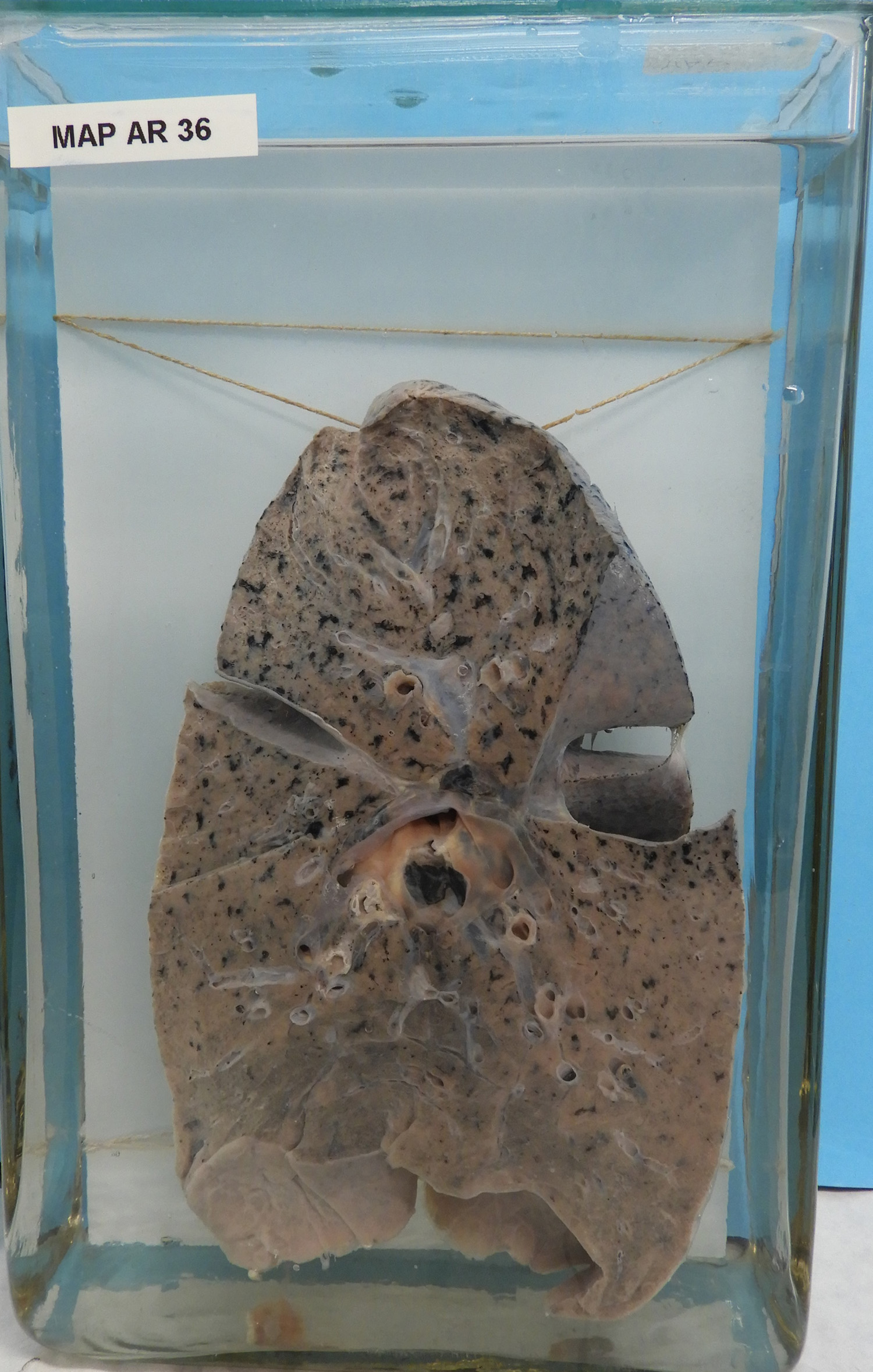 preparato anatomico, apparato respiratorio (morfologia naturale) (SECOLI/ XX)