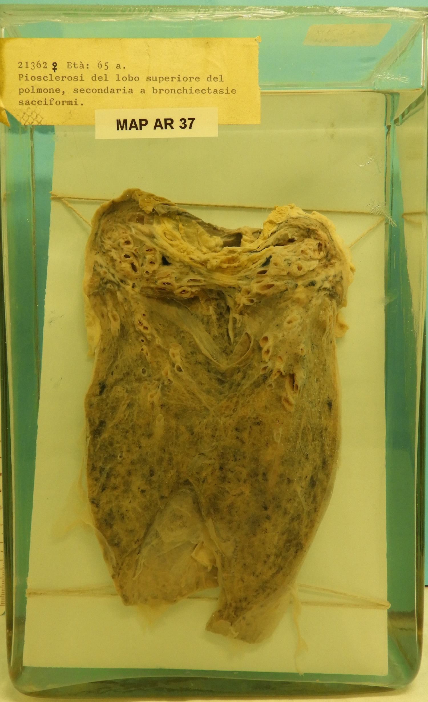 preparato anatomico, apparato respiratorio (morfologia naturale) (SECOLI/ XX)