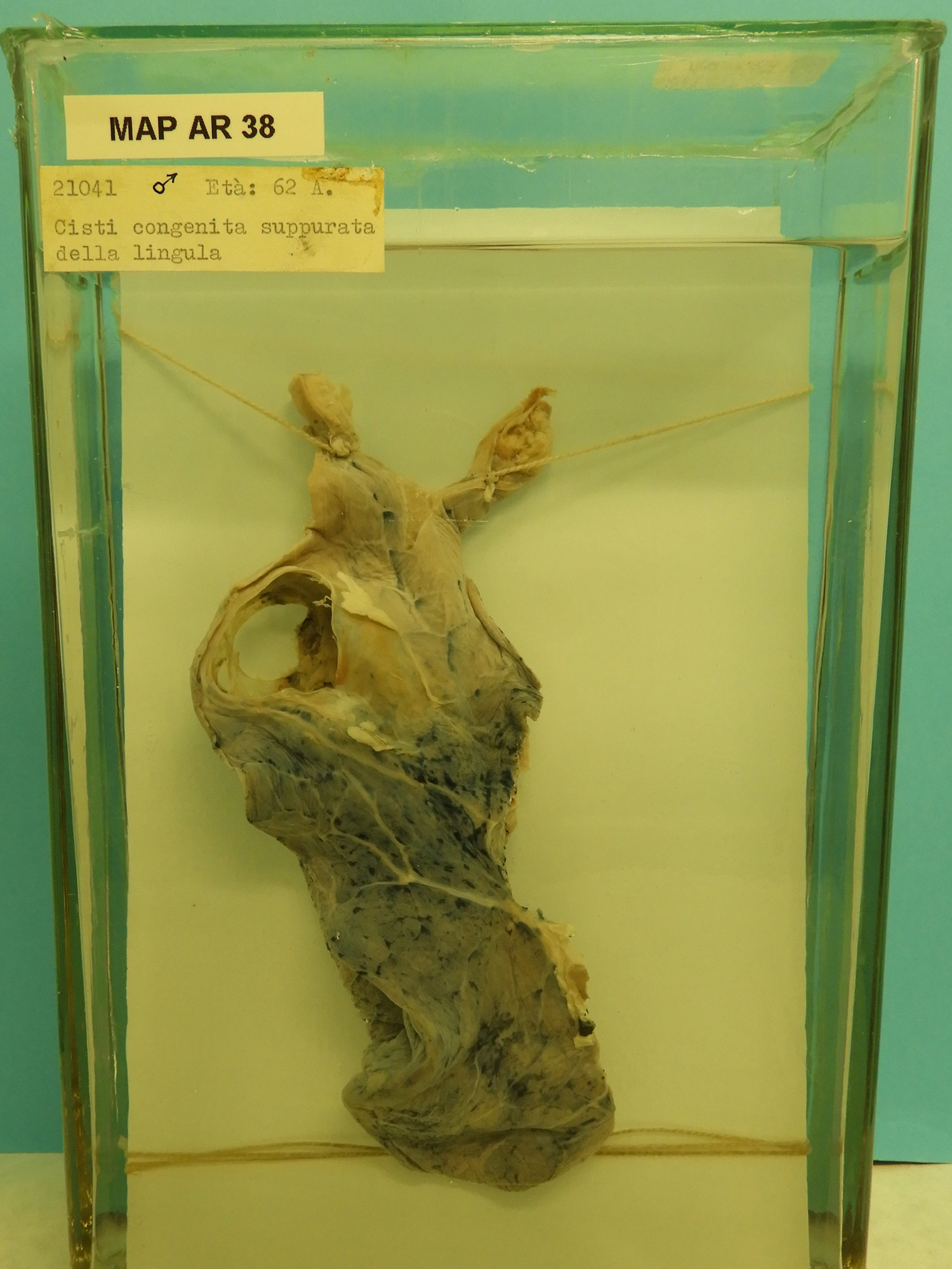 preparato anatomico, apparato respiratorio (morfologia naturale) (SECOLI/ XX)