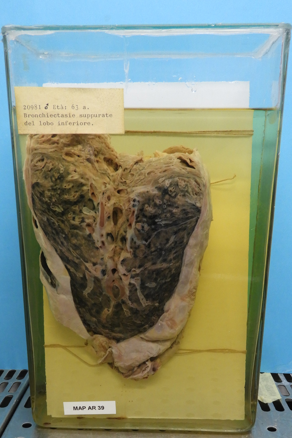 preparato anatomico, apparato respiratorio (morfologia naturale) (SECOLI/ XX)