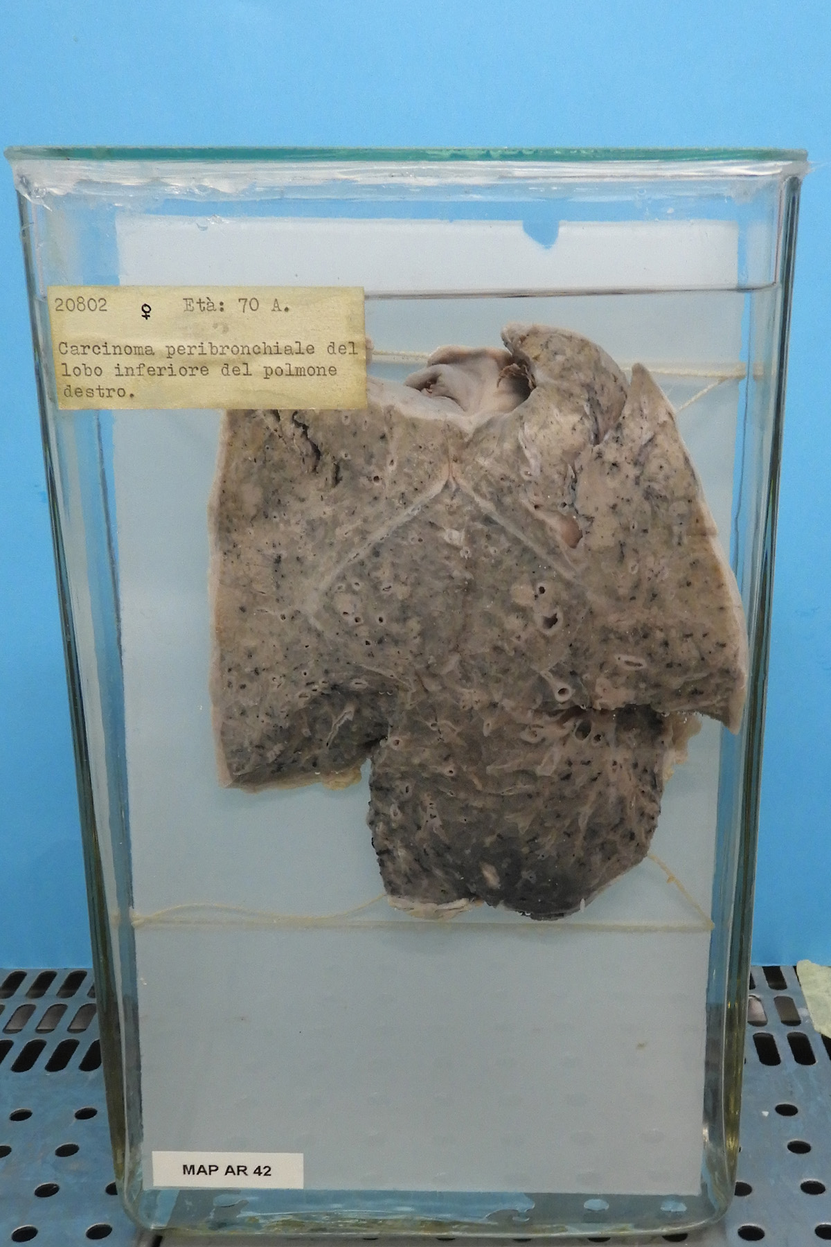 preparato anatomico, apparato respiratorio (morfologia naturale) (SECOLI/ XX)