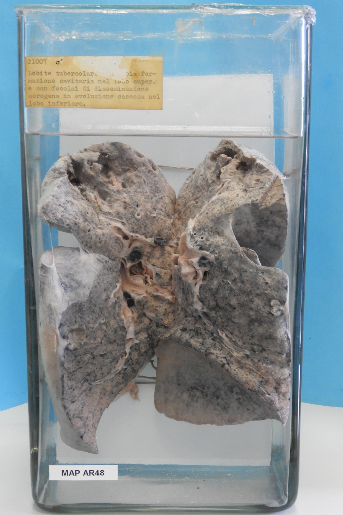 preparato anatomico, apparato respiratorio (morfologia naturale) (SECOLI/ XX)