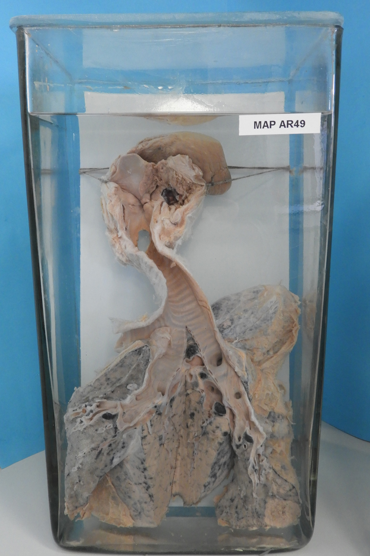 preparato anatomico, apparato respiratorio (morfologia naturale) (SECOLI/ XX)