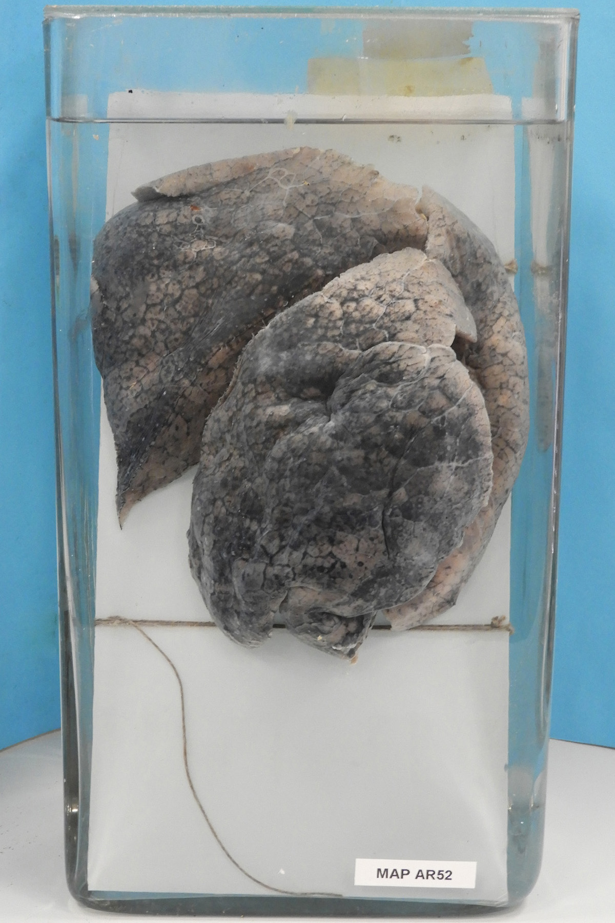 preparato anatomico, apparato respiratorio (morfologia naturale) (SECOLI/ XX)