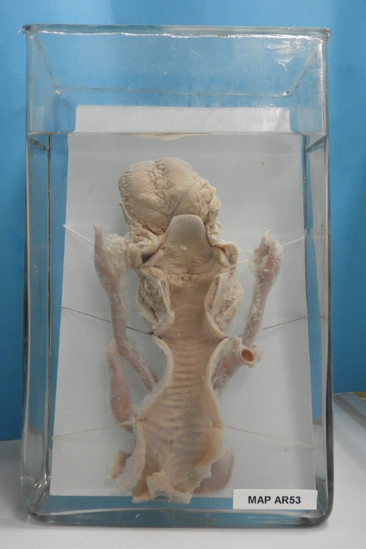 preparato anatomico, apparato respiratorio (morfologia naturale) (SECOLI/ XX)