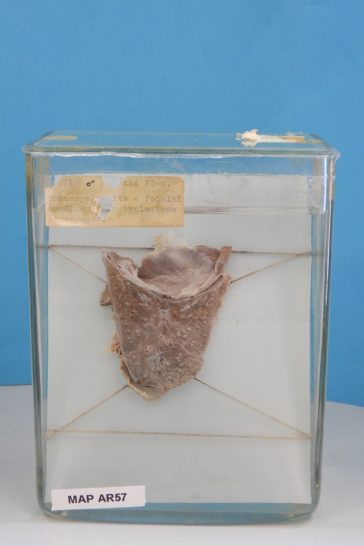 preparato anatomico, apparato respiratorio (morfologia naturale) (SECOLI/ XX)