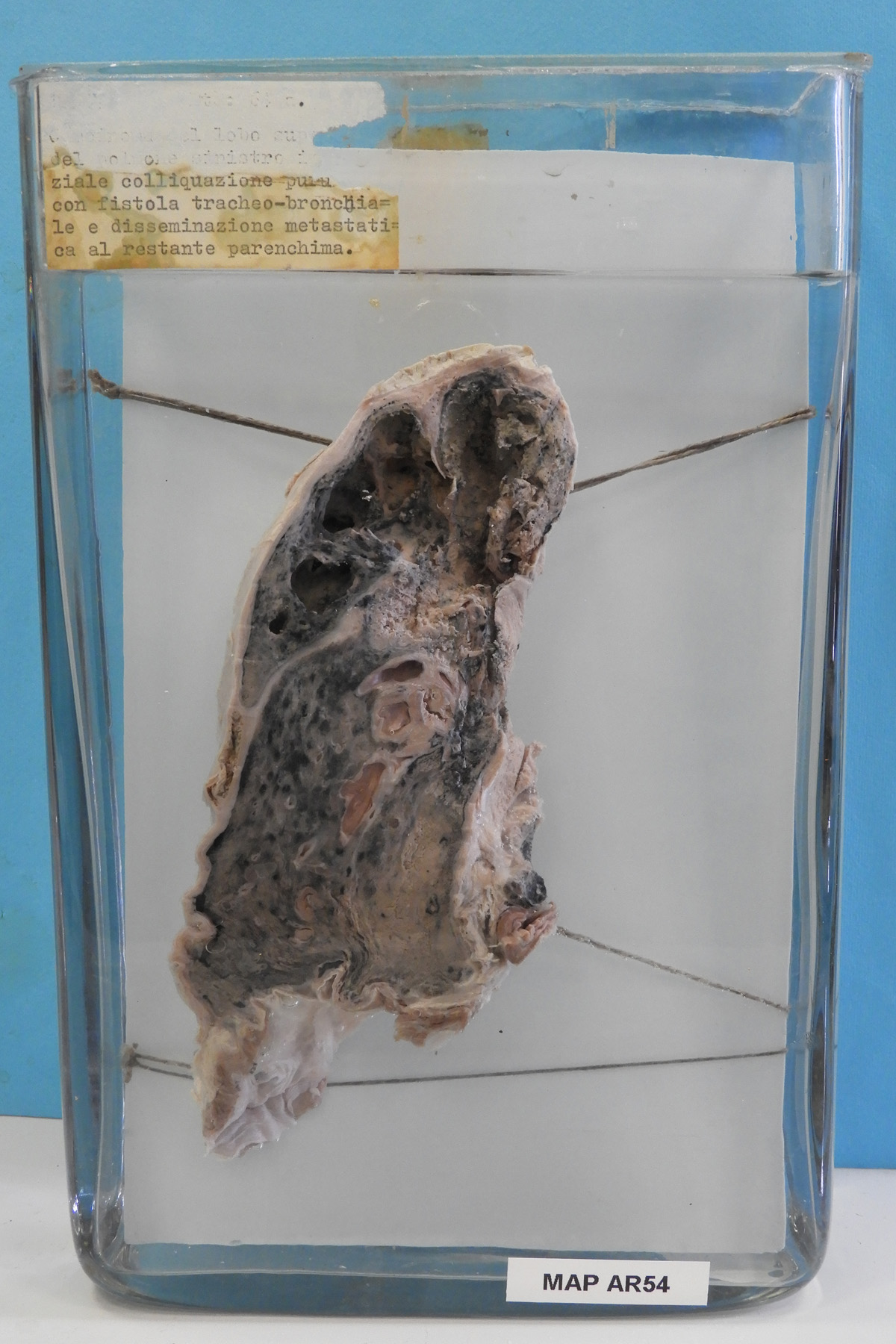 preparato anatomico, apparato respiratorio (morfologia naturale) (SECOLI/ XX)