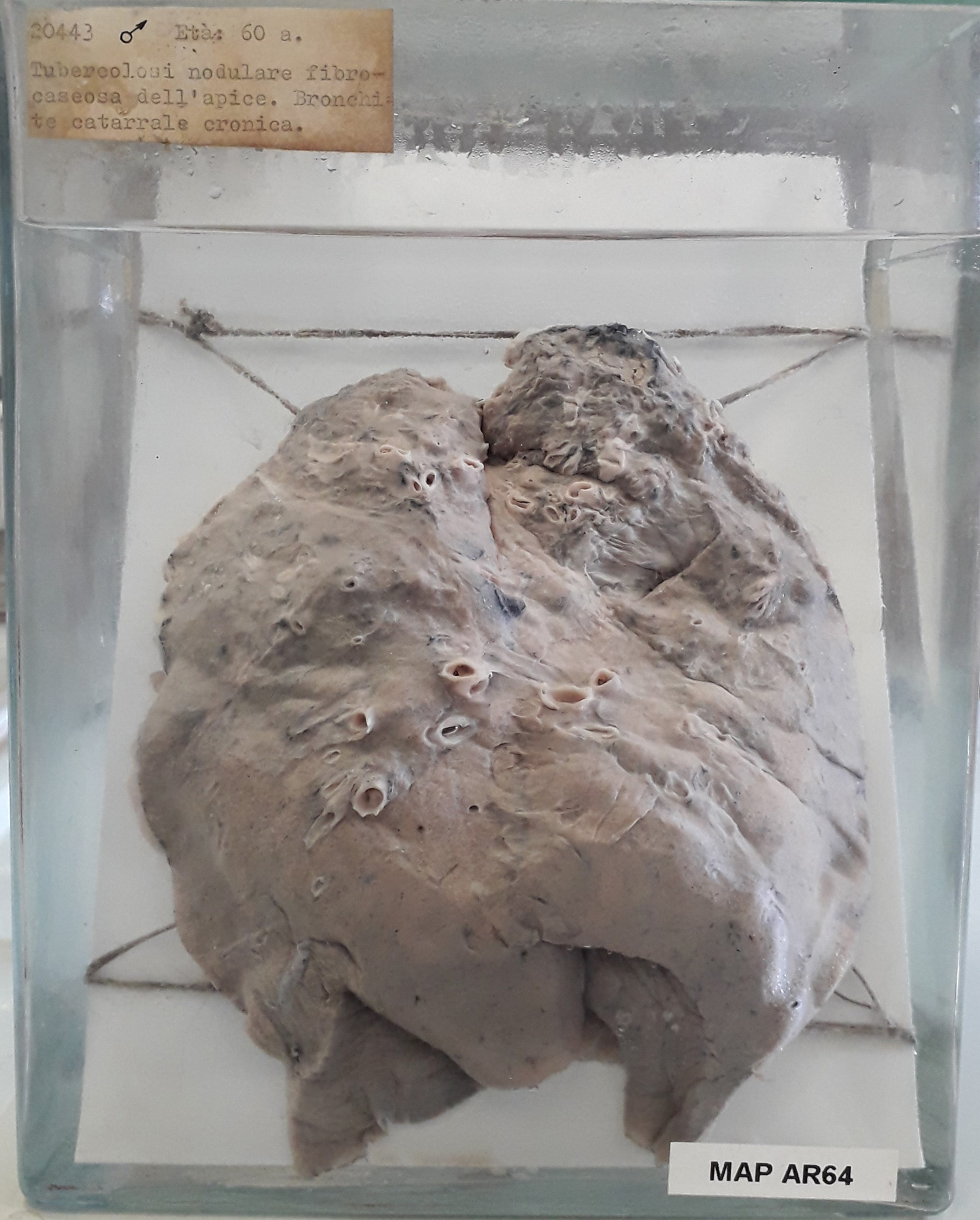 preparato anatomico, apparato respiratorio (morfologia naturale) (SECOLI/ XX)