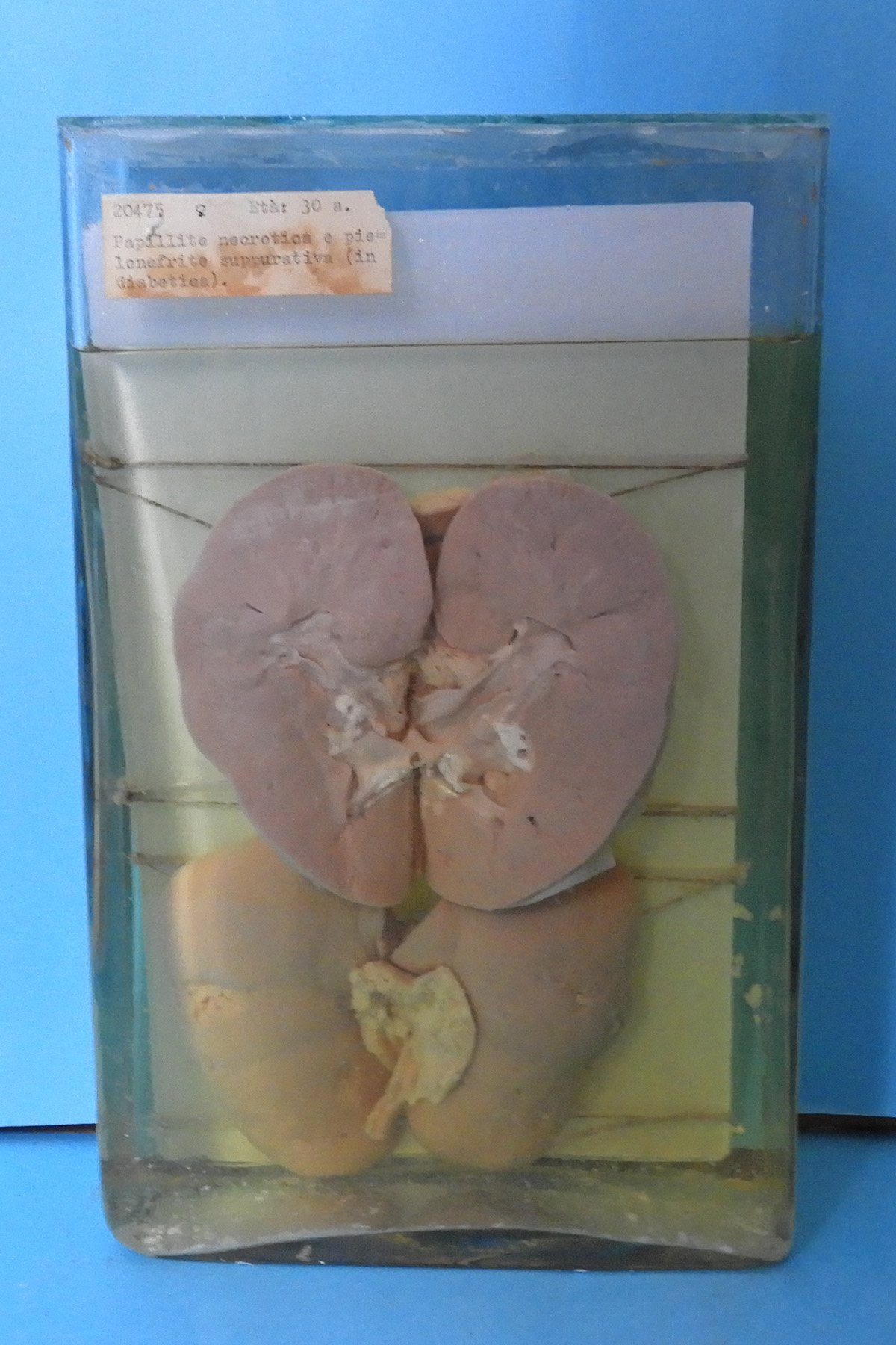 preparato anatomico, apparato urogenitale (morfologia naturale) (SECOLI/ XX)
