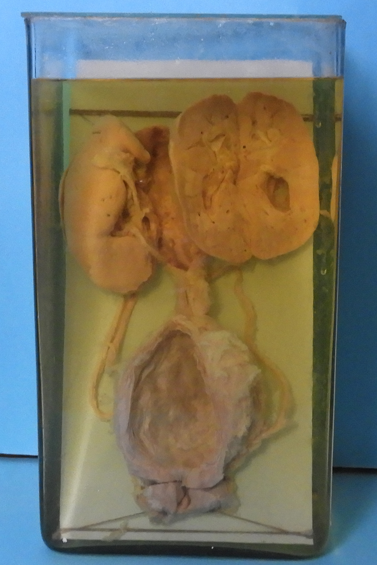 preparato anatomico, apparato urogenitale (morfologia naturale) (SECOLI/ XX)