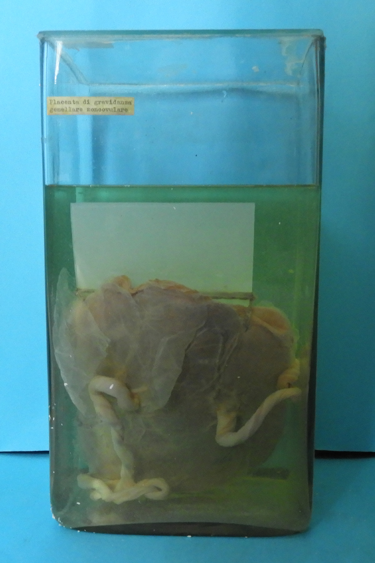 preparato anatomico, apparato urogenitale (morfologia naturale) (SECOLI/ XX)