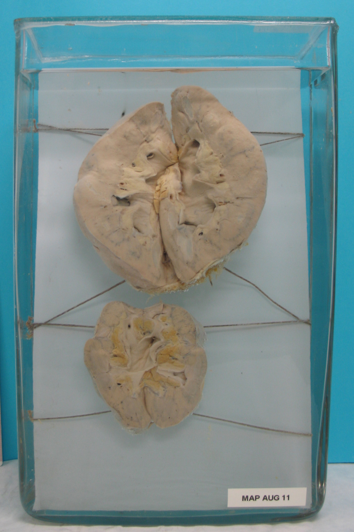 preparato anatomico, apparato urogenitale (morfologia naturale) (SECOLI/ XX)