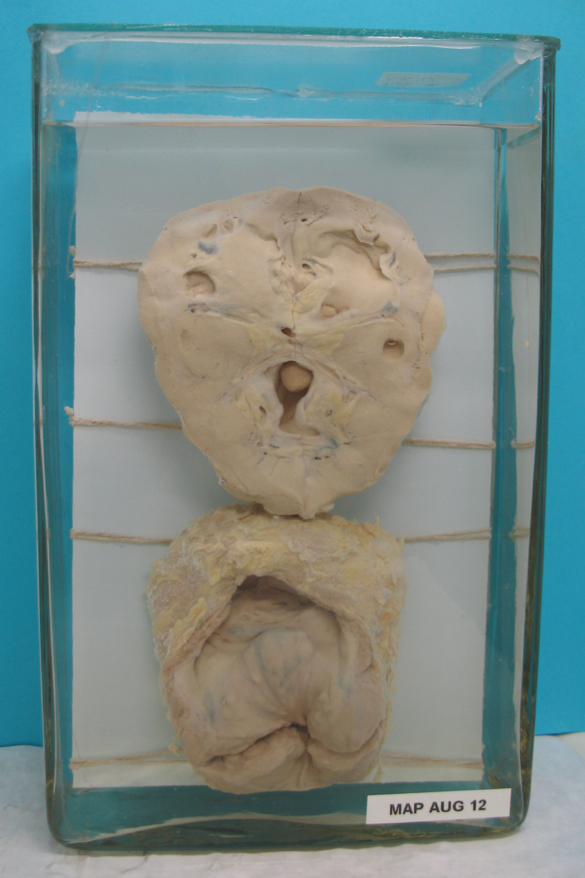 preparato anatomico, apparato urogenitale (morfologia naturale) (SECOLI/ XX)