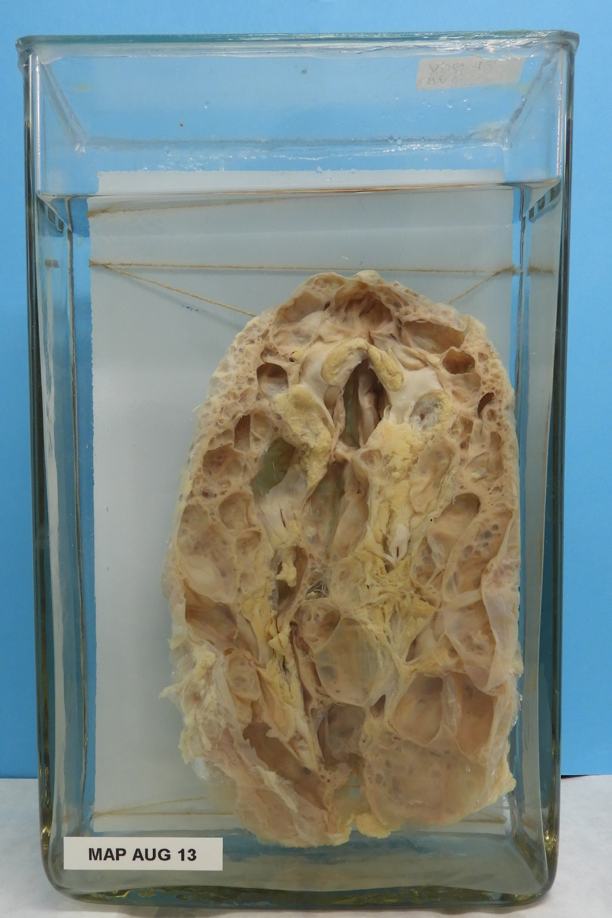 preparato anatomico, apparato urogenitale (morfologia naturale) (SECOLI/ XX)