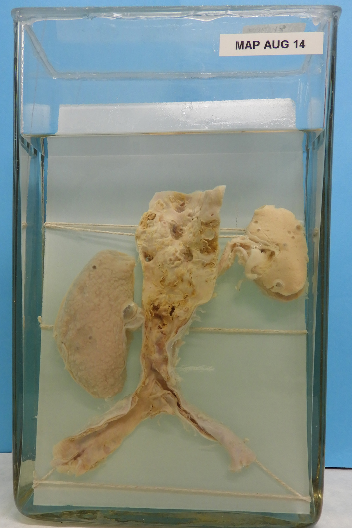 preparato anatomico, apparato urogenitale (morfologia naturale) (SECOLI/ XX)